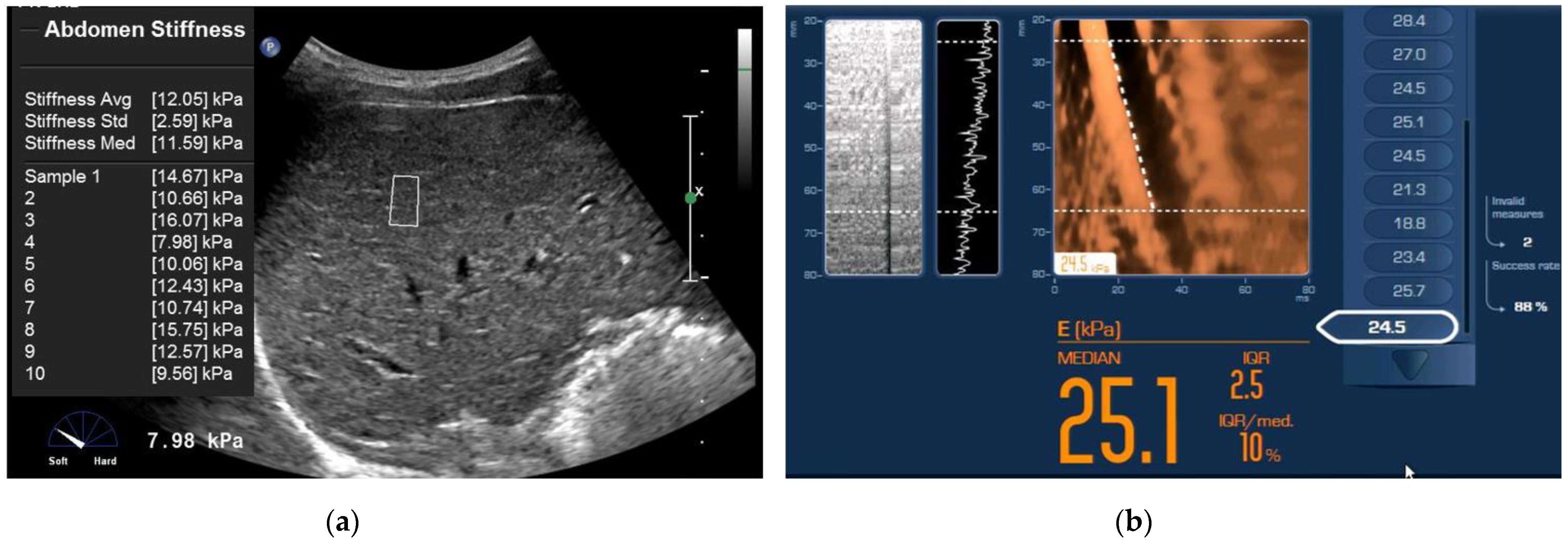 Diagnostics 12 00706 g002 Diagnostics 12 00706 g002