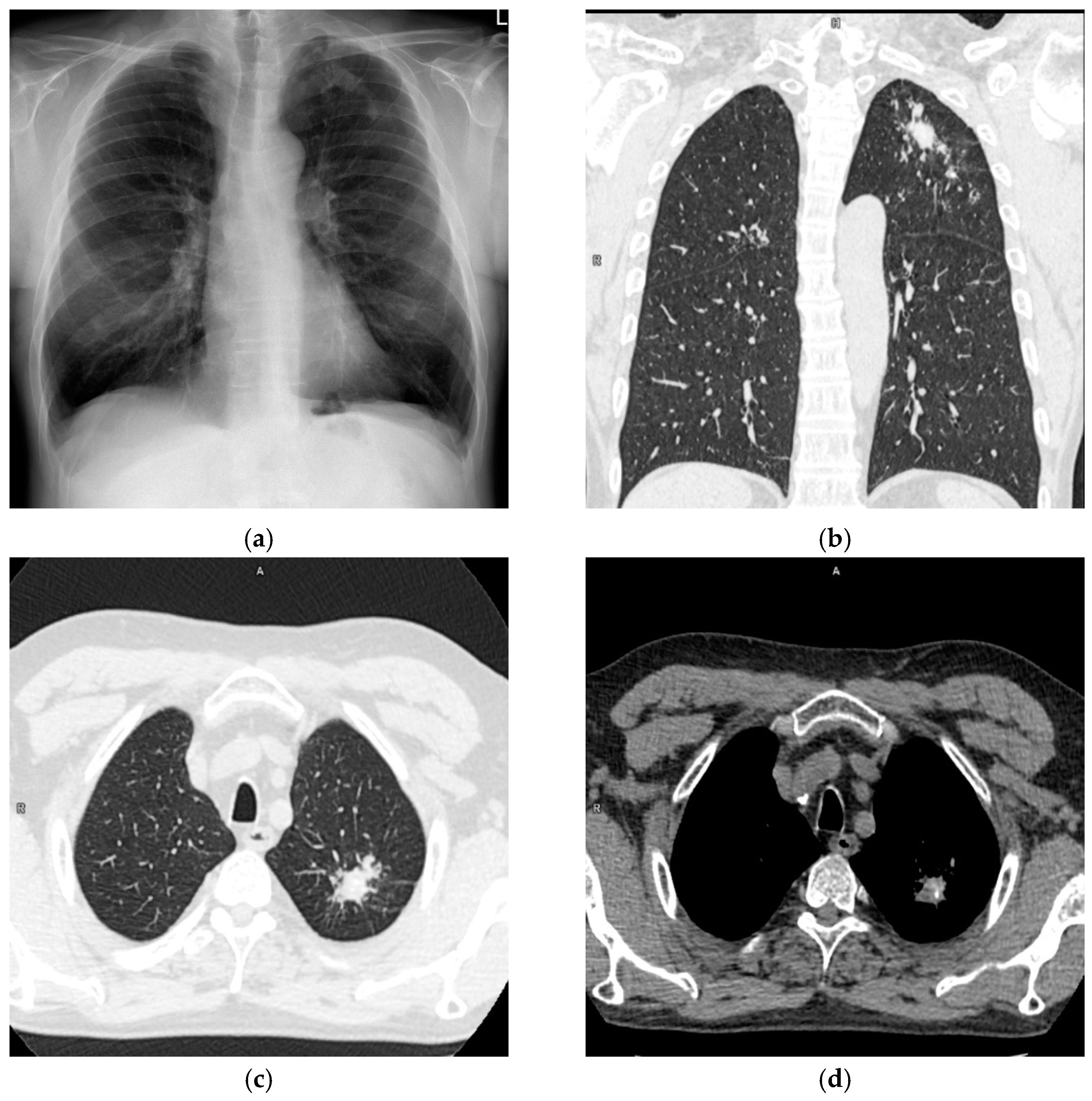 Diagnostics Free FullText Use of a FluoroType® System for the