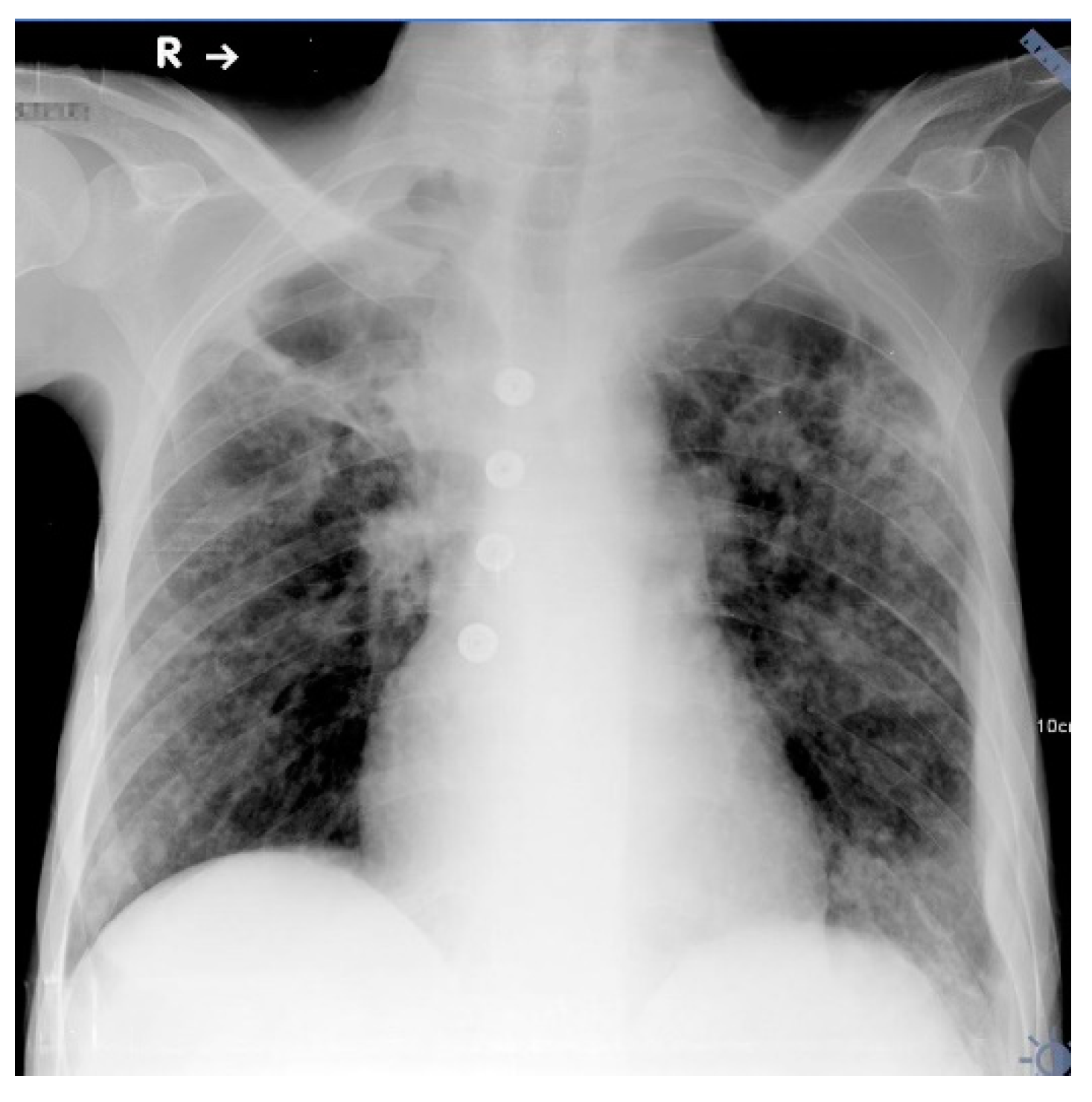 Diagnostics 12 00711 g002 550