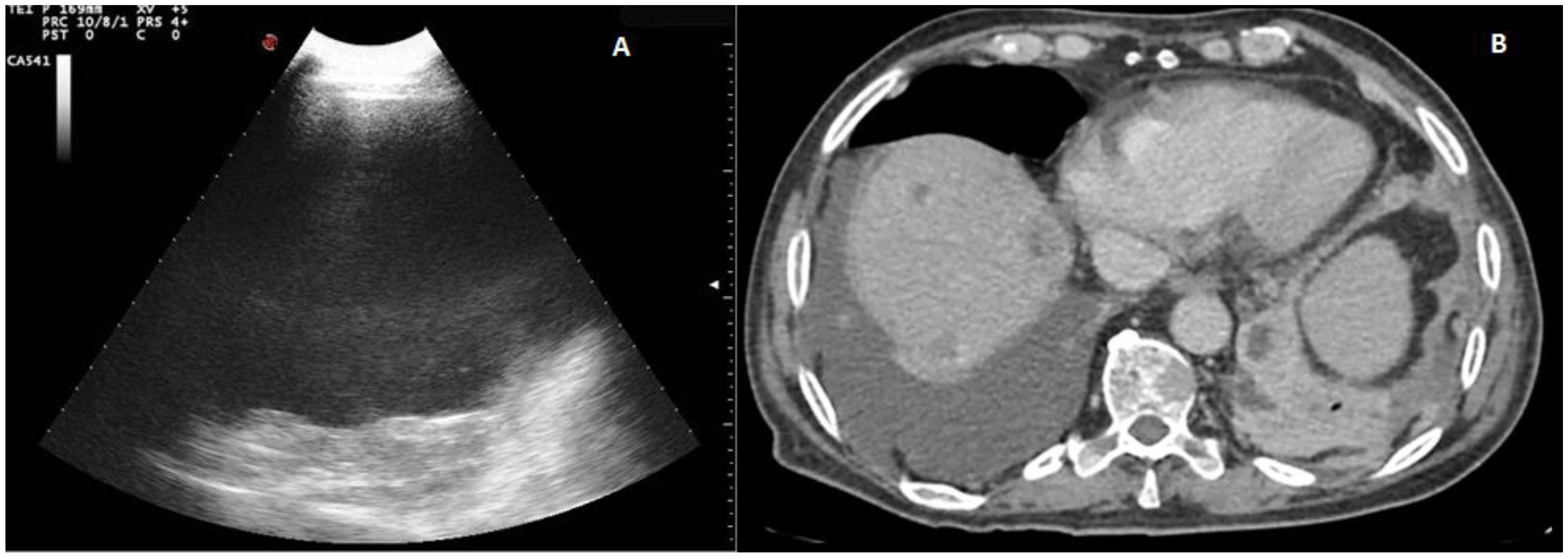 Diagnostics 12 00725 g004