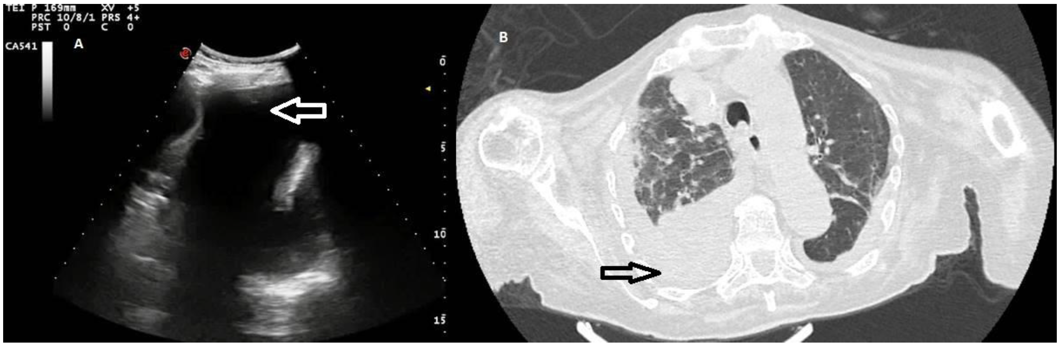 Diagnostics 12 00725 g005