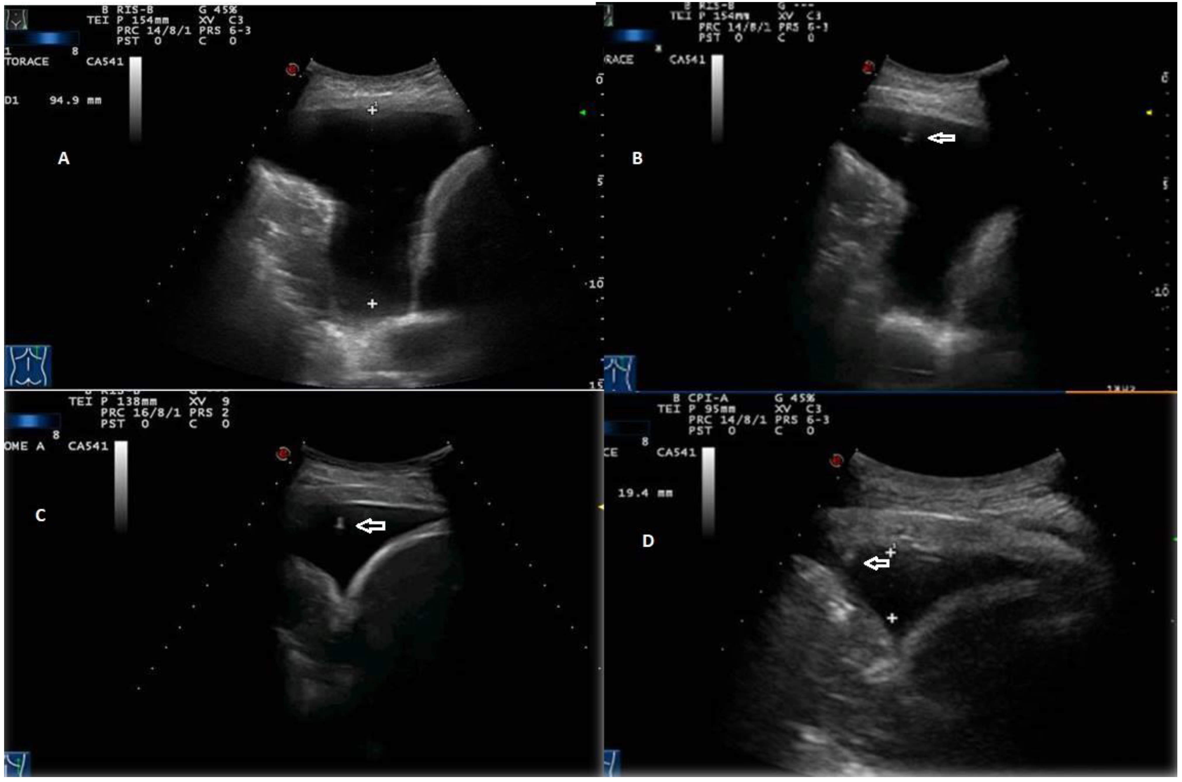 Diagnostics 12 00725 g007