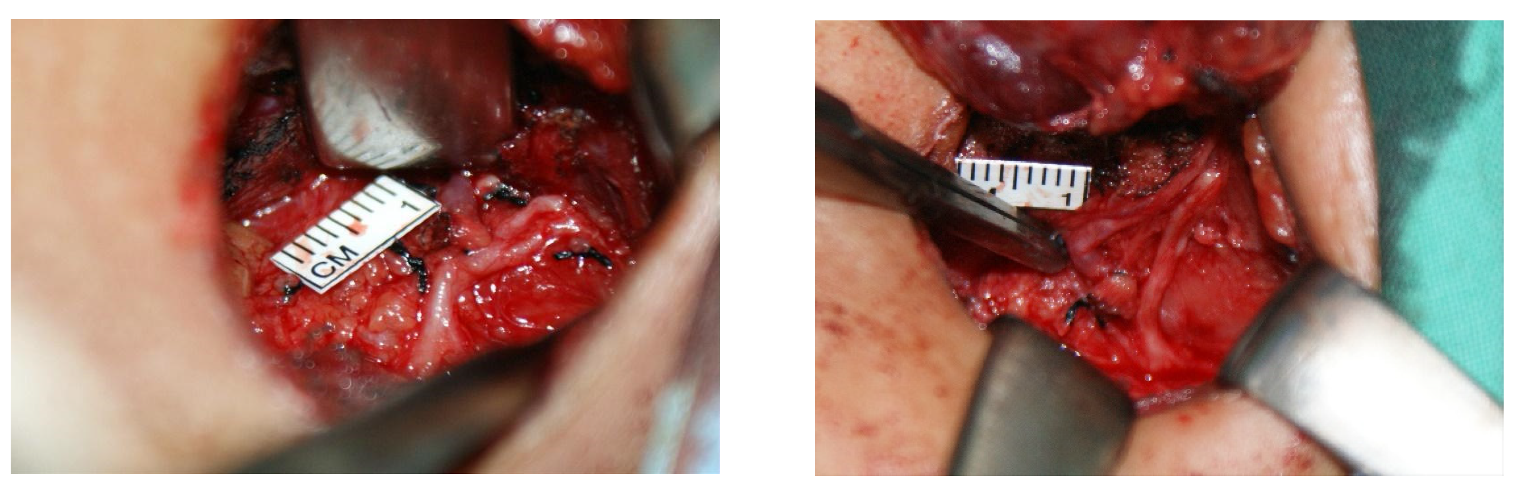 Diagnostics 12 00730 g002