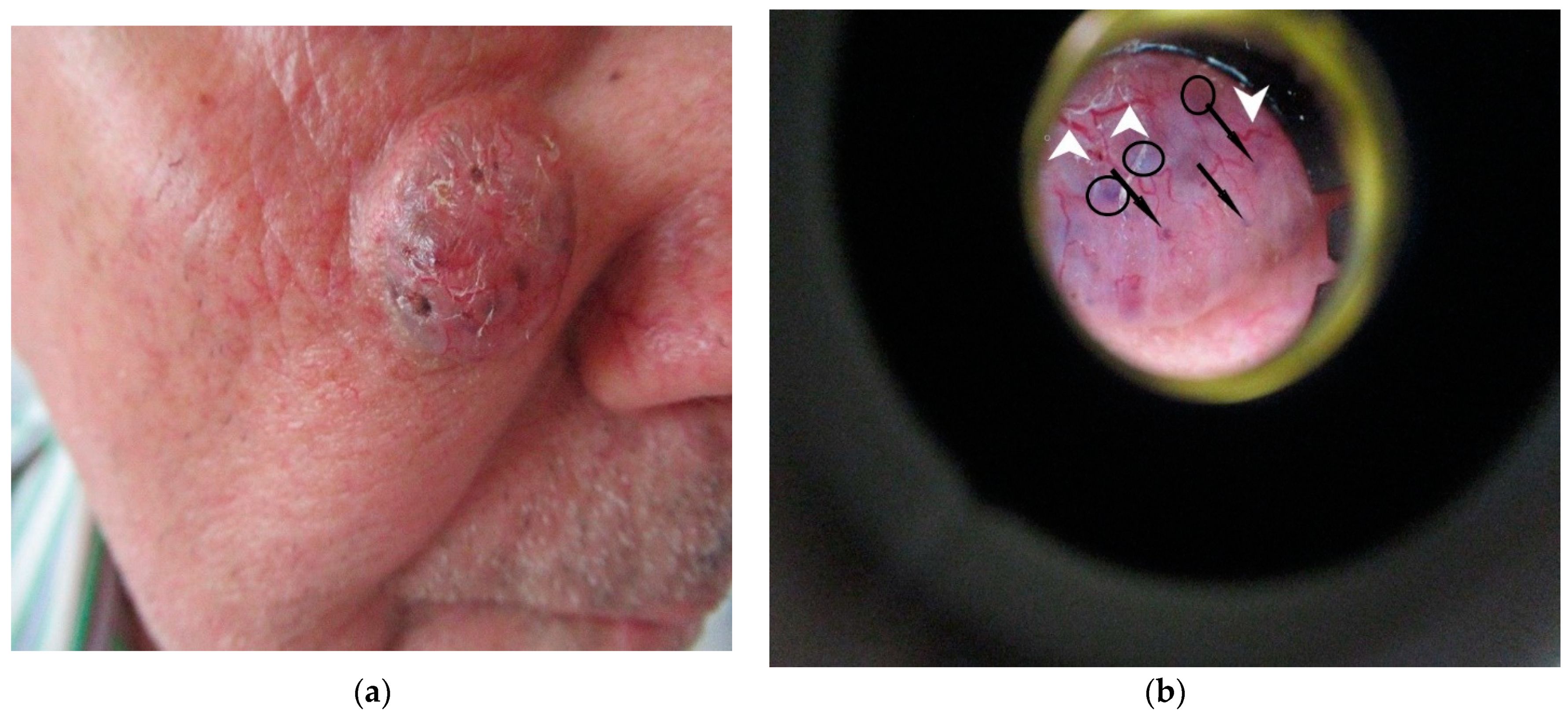 Diagnostics 12 00735 g001 550