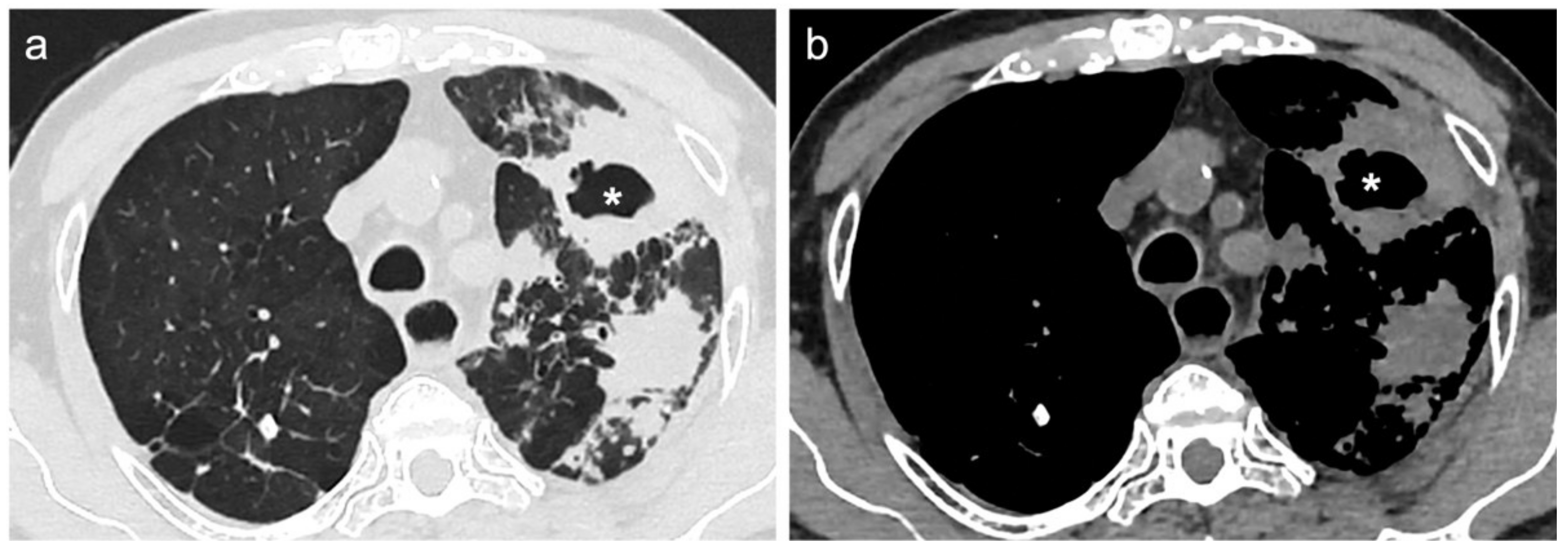 Diagnostics 12 00739 g002