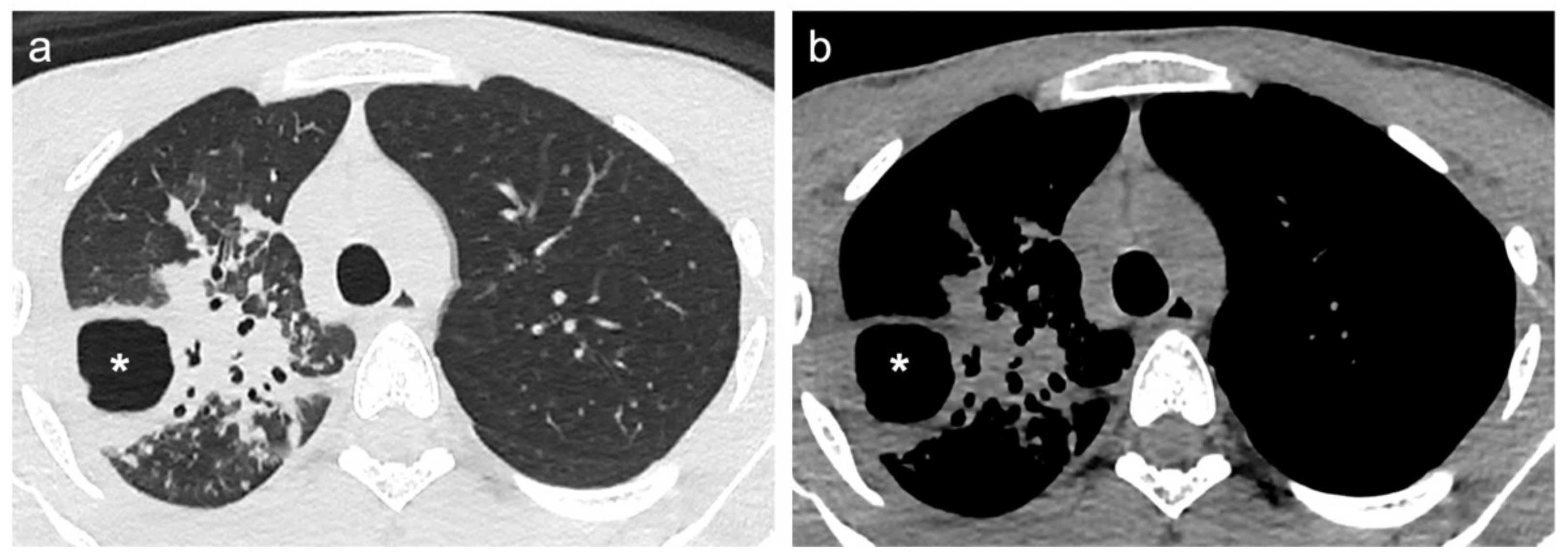 Diagnostics 12 00739 g003