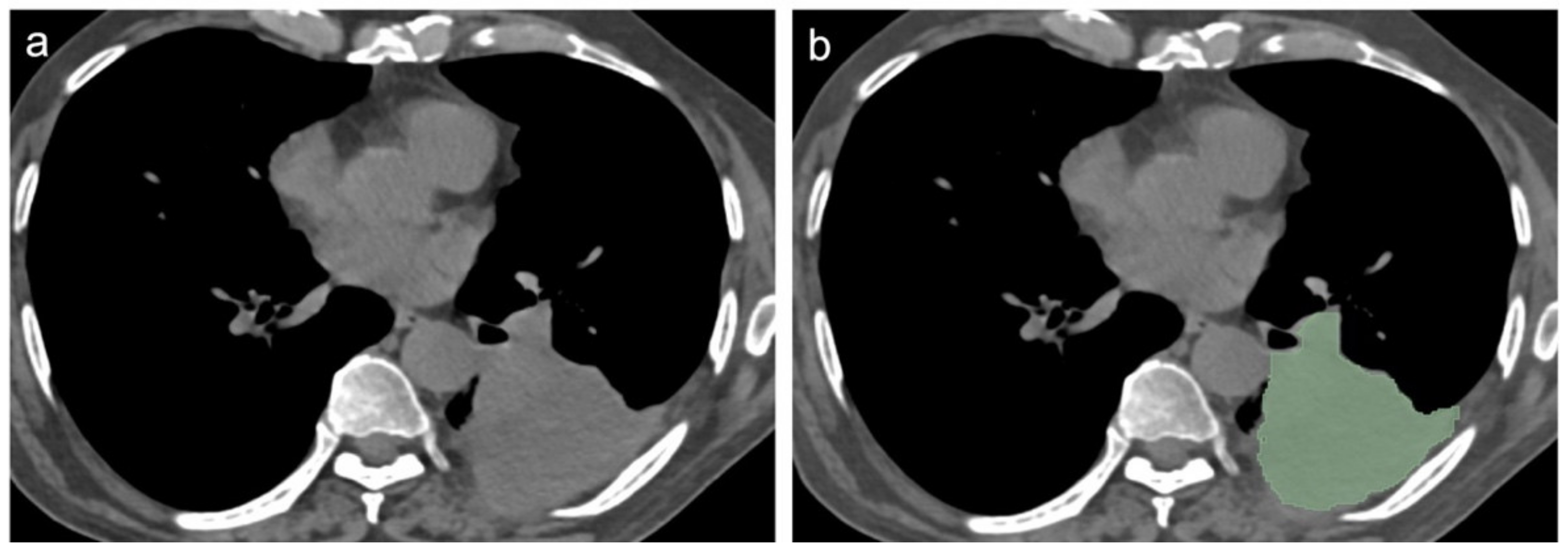 Diagnostics 12 00739 g004