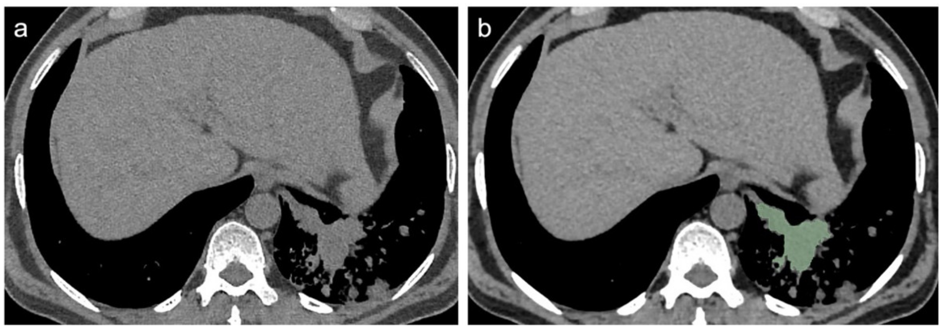Diagnostics 12 00739 g005