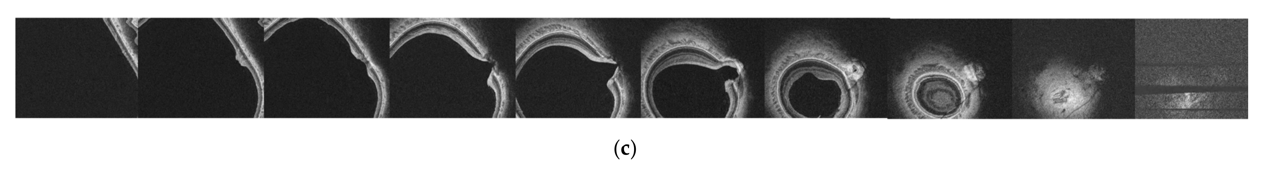 Diagnostics 12 00742 g001b