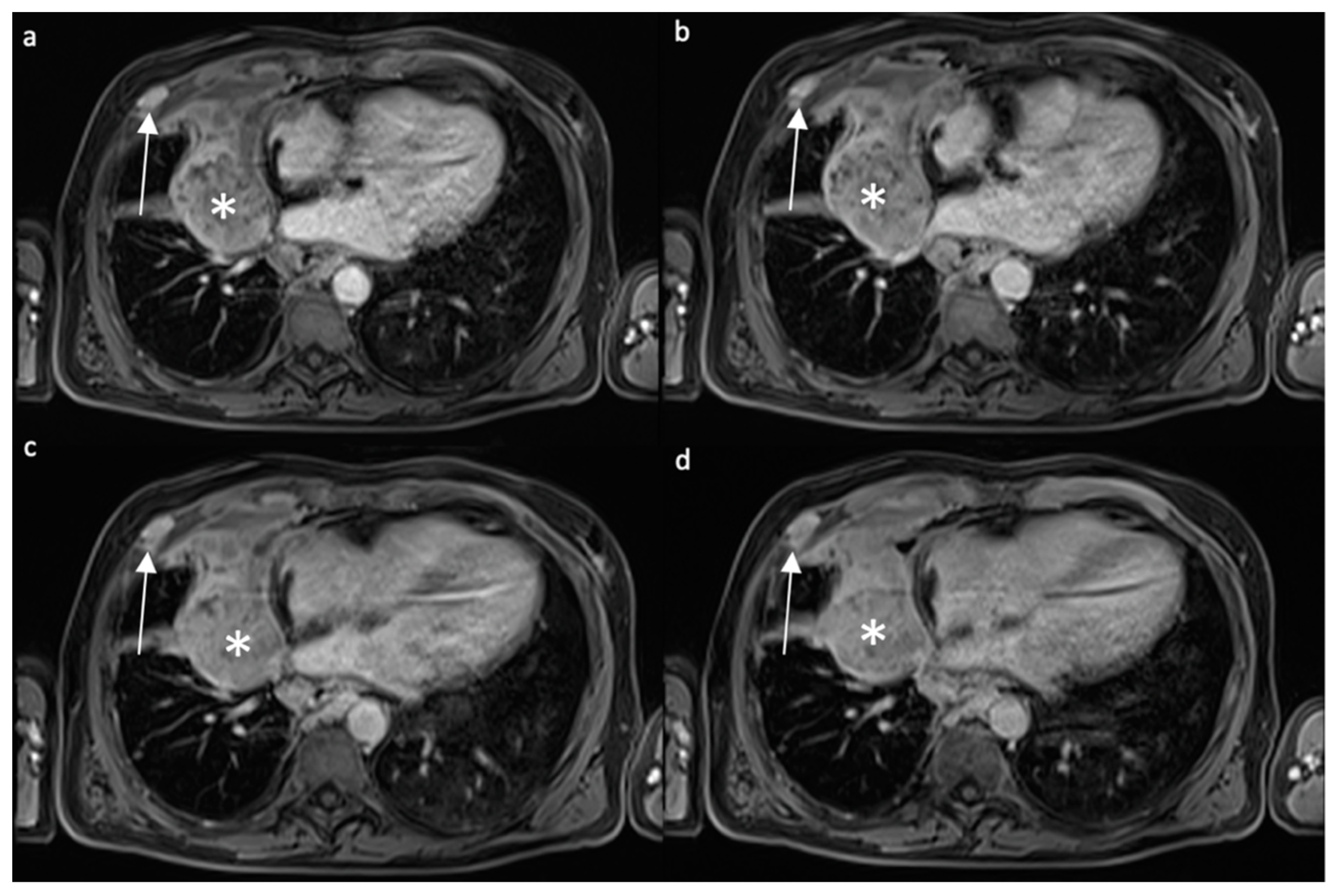 Diagnostics 12 00750 g003 550