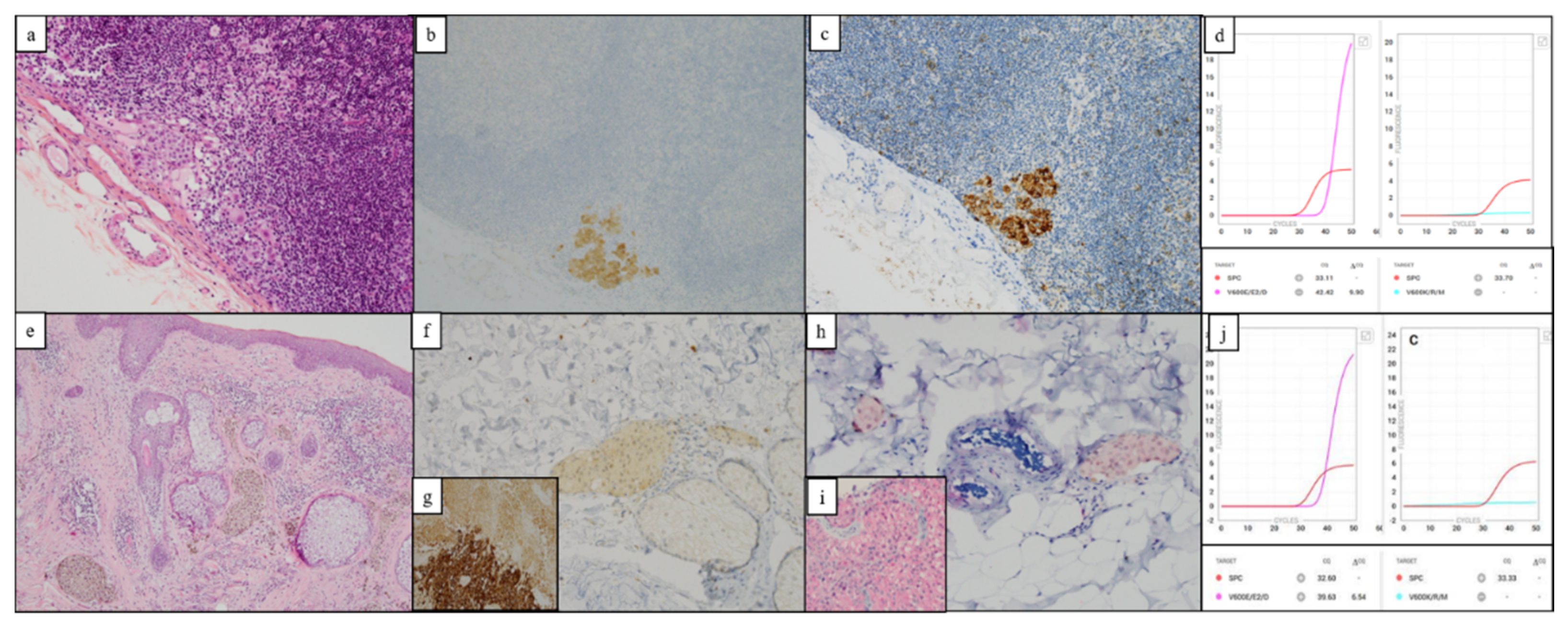 Diagnostics 12 00751 g002 Diagnostics 12 00751 g002