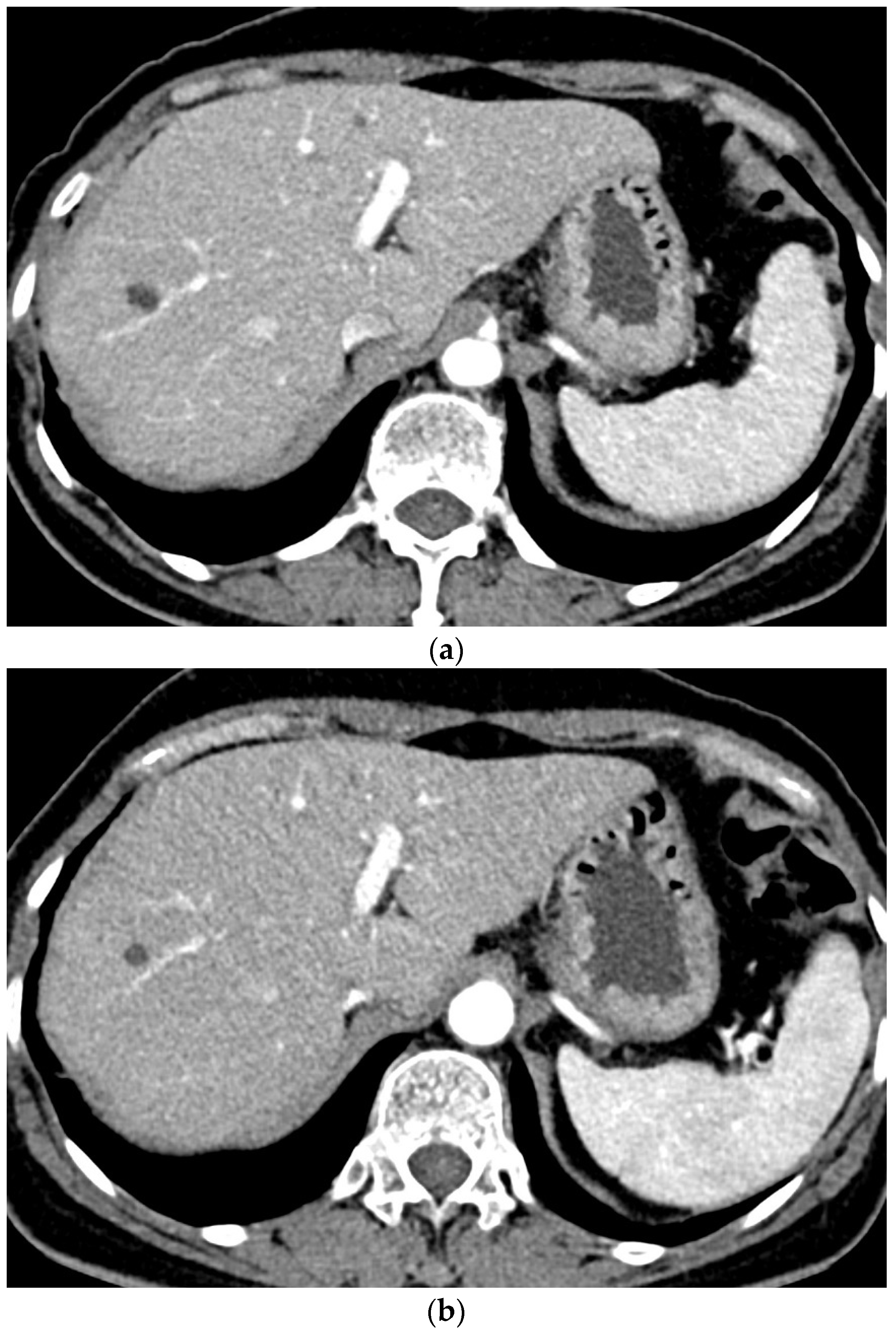 Diagnostics 12 00752 g003