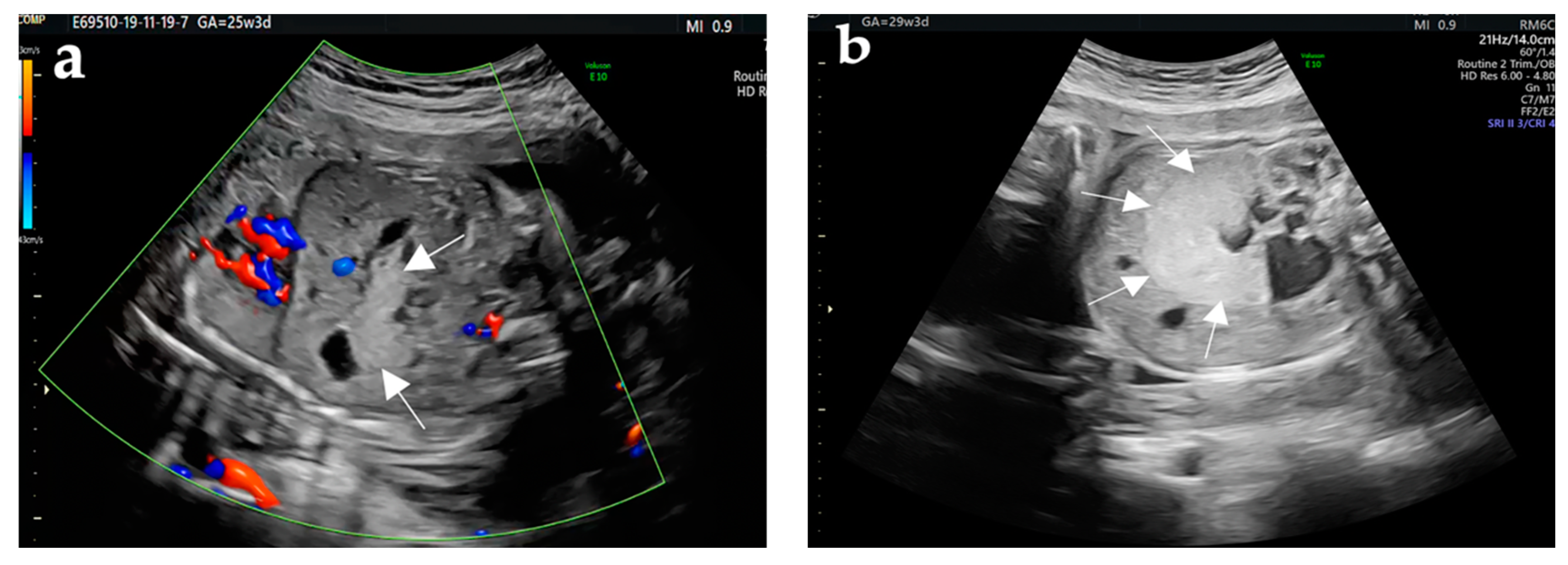 Diagnostics 12 00758 g001a
