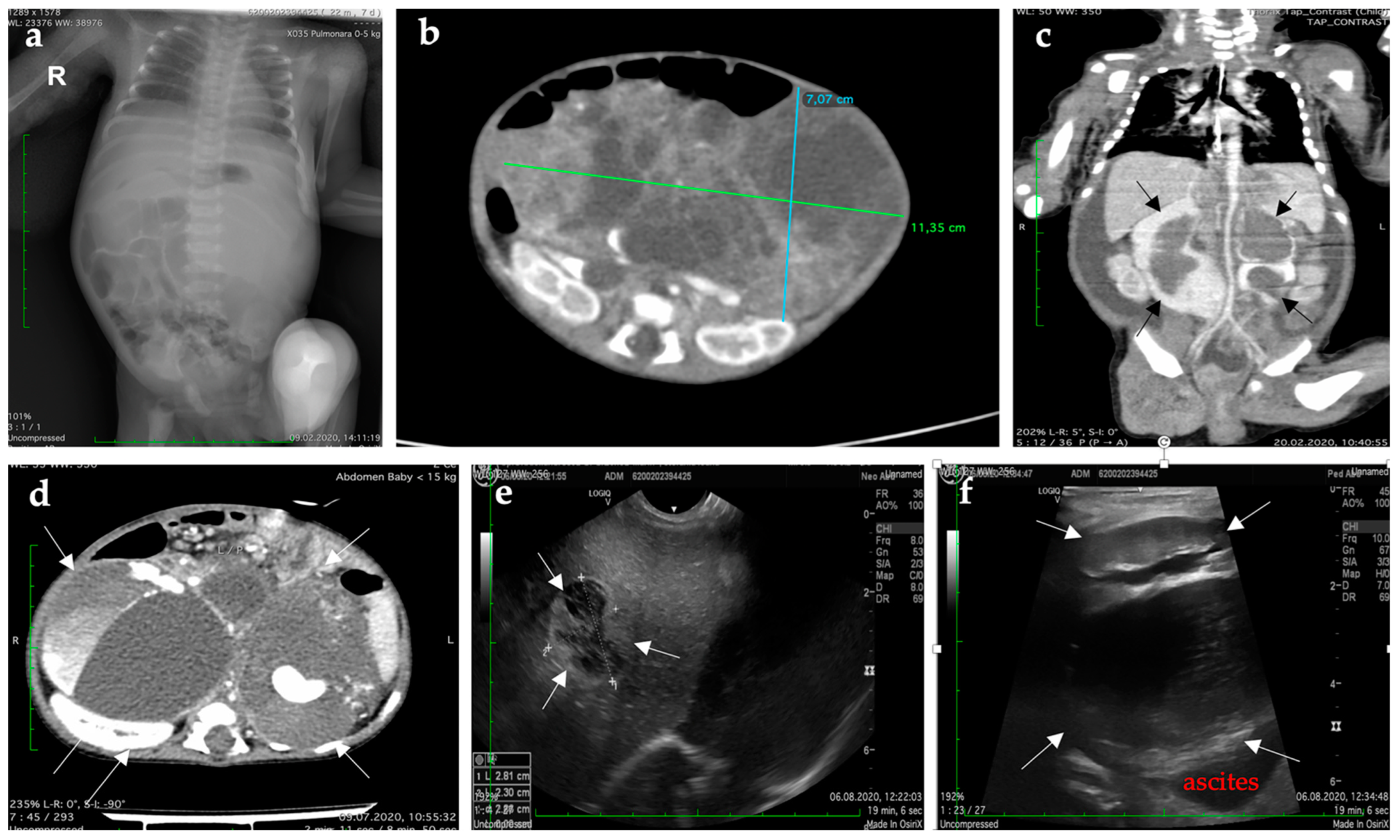 Diagnostics 12 00758 g002