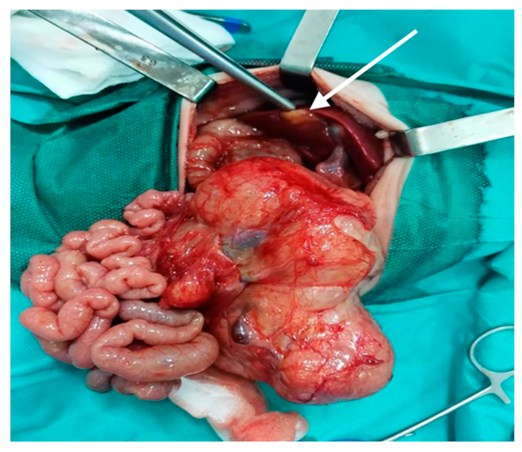 Diagnostics 12 00758 g003