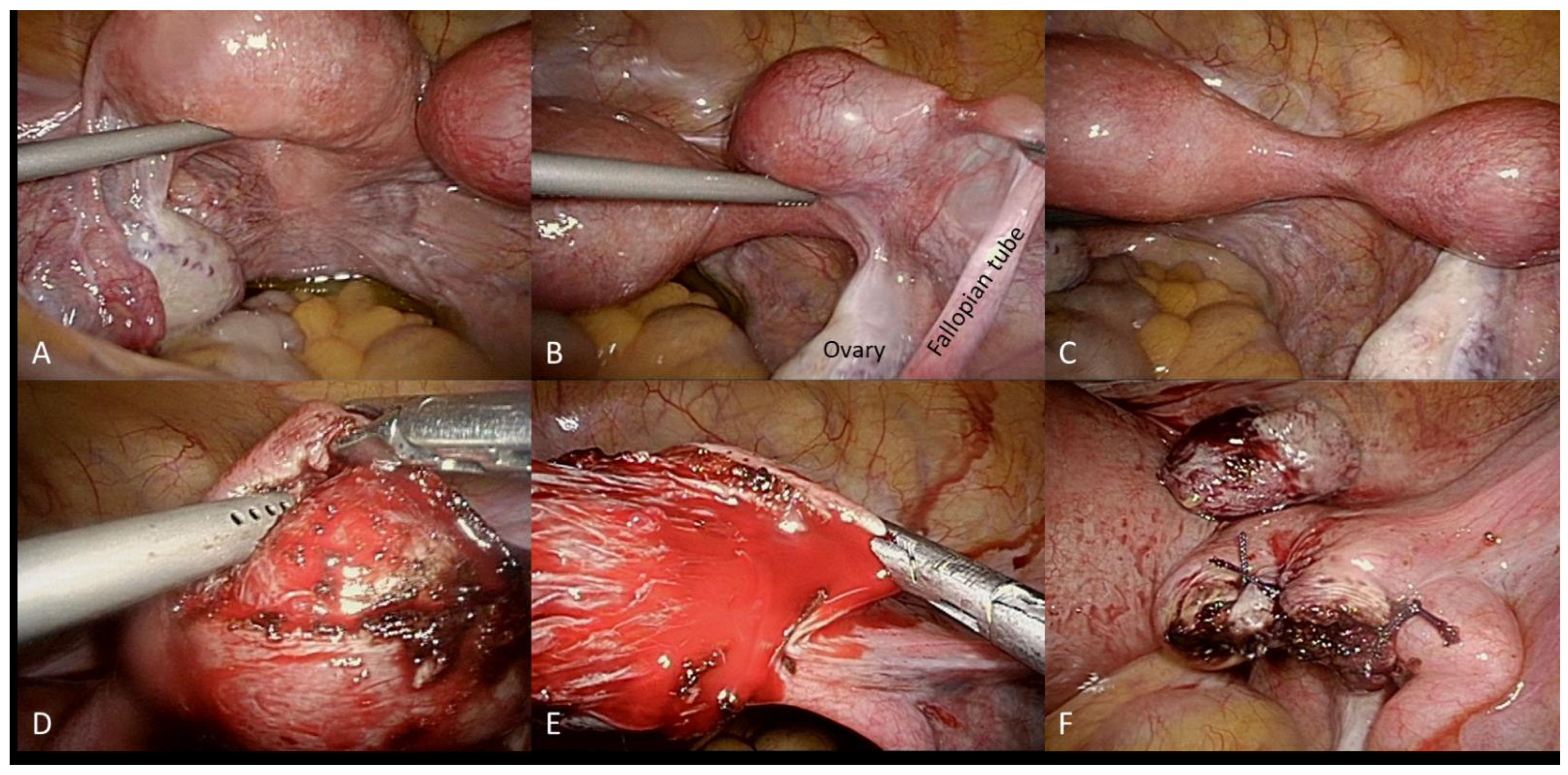 Diagnostics 12 00759 g003