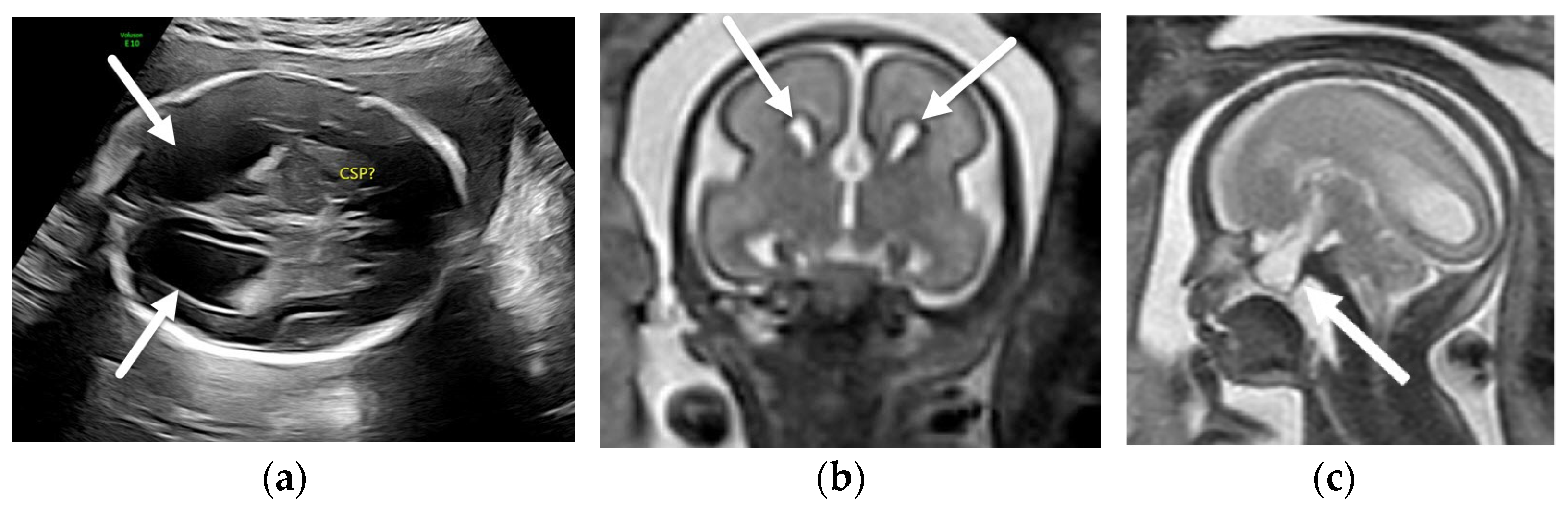 Diagnostics 12 00764 g006
