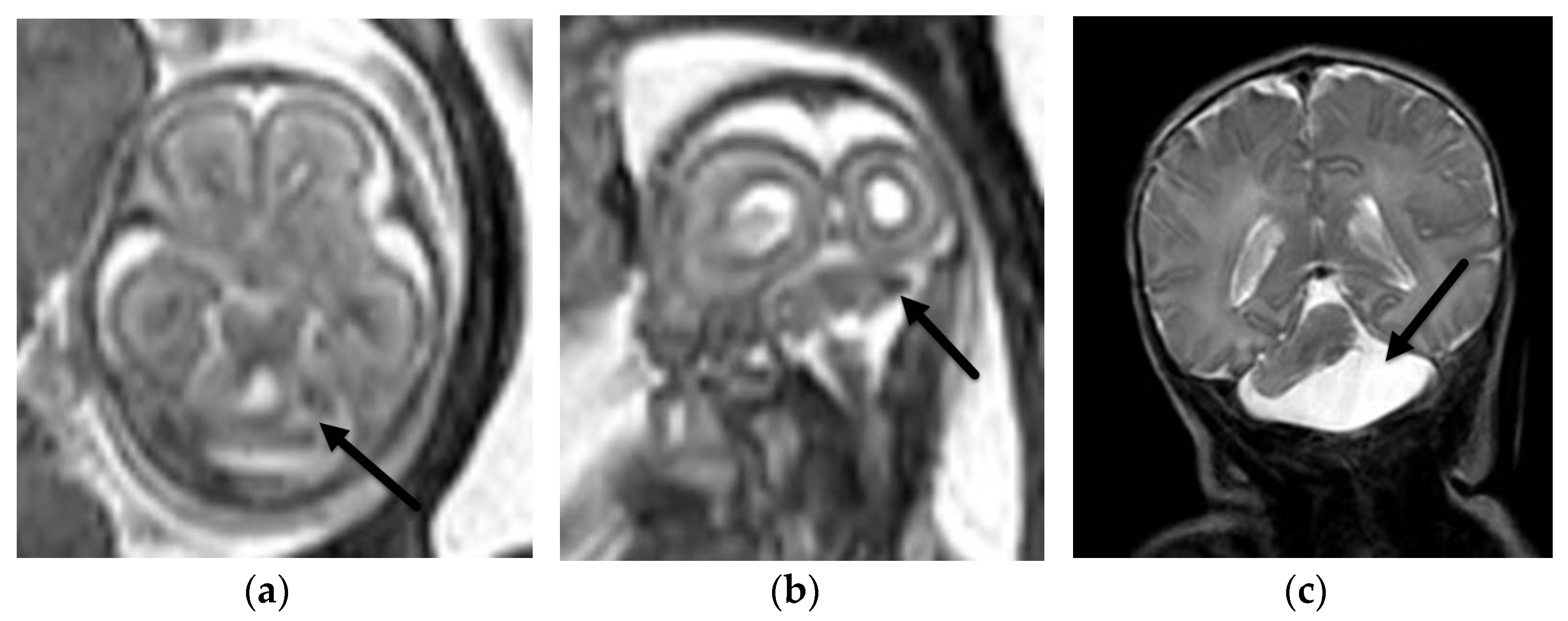 Diagnostics 12 00764 g009