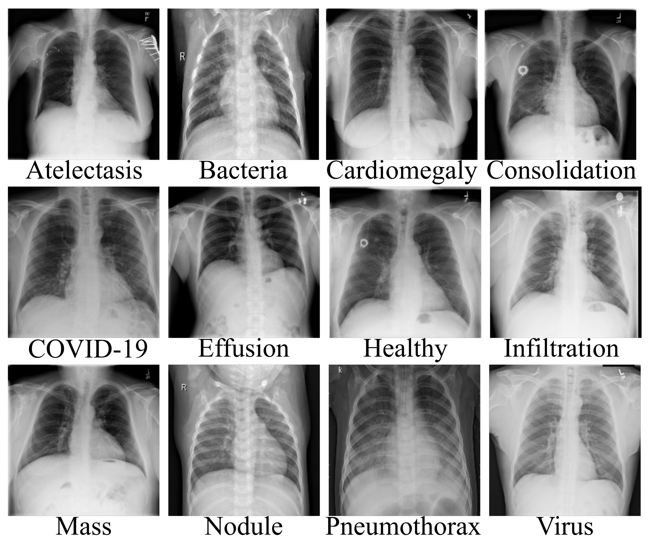 Diagnostics 12 00765 g001 550