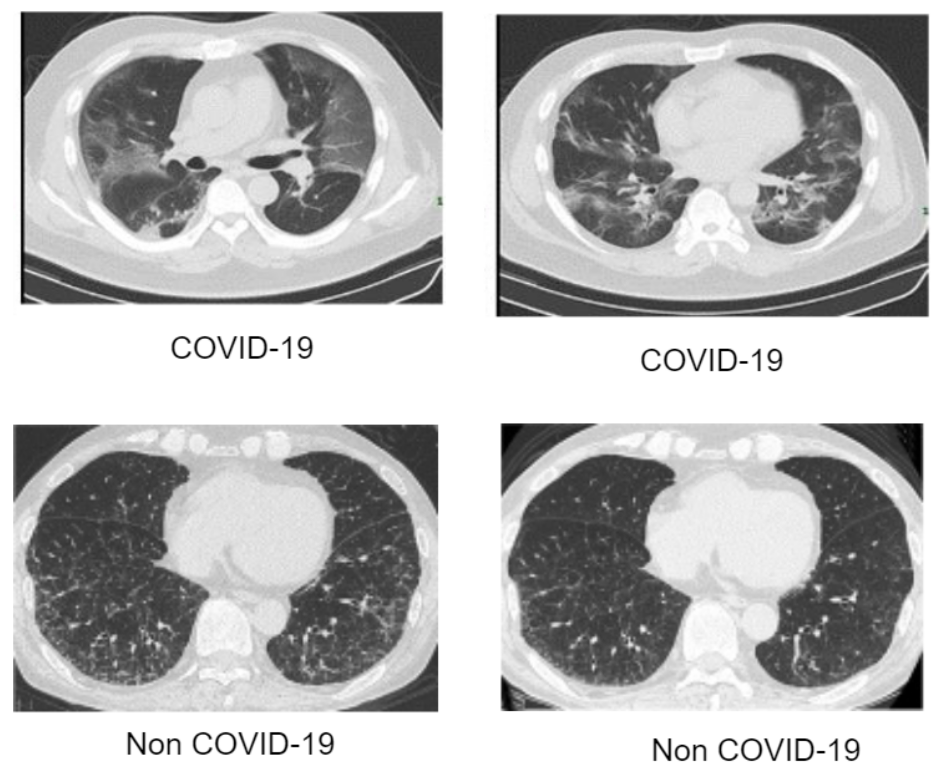 Diagnostics 12 00765 g002 550