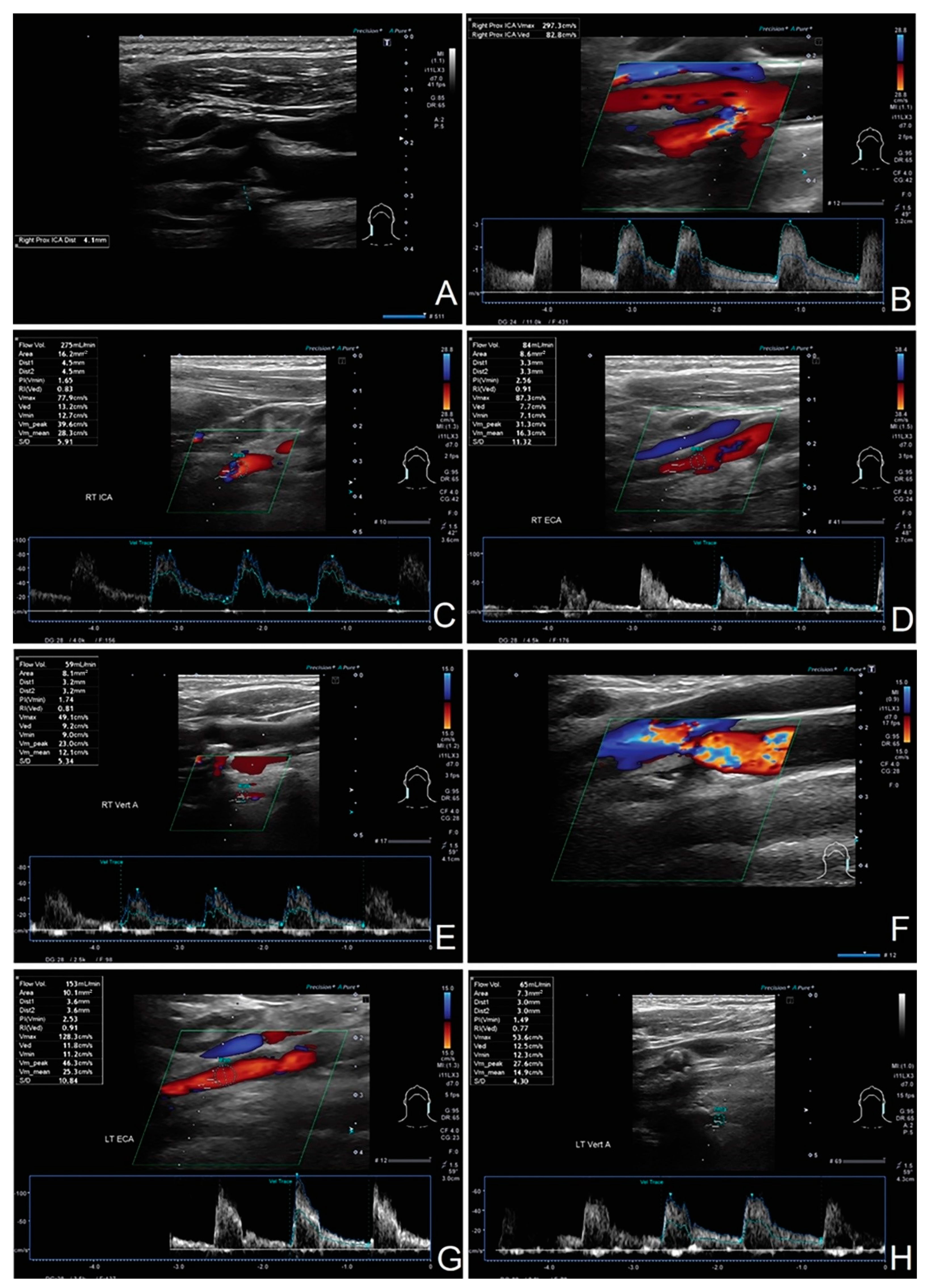 Diagnostics 12 00766 g011 Diagnostics 12 00766 g011