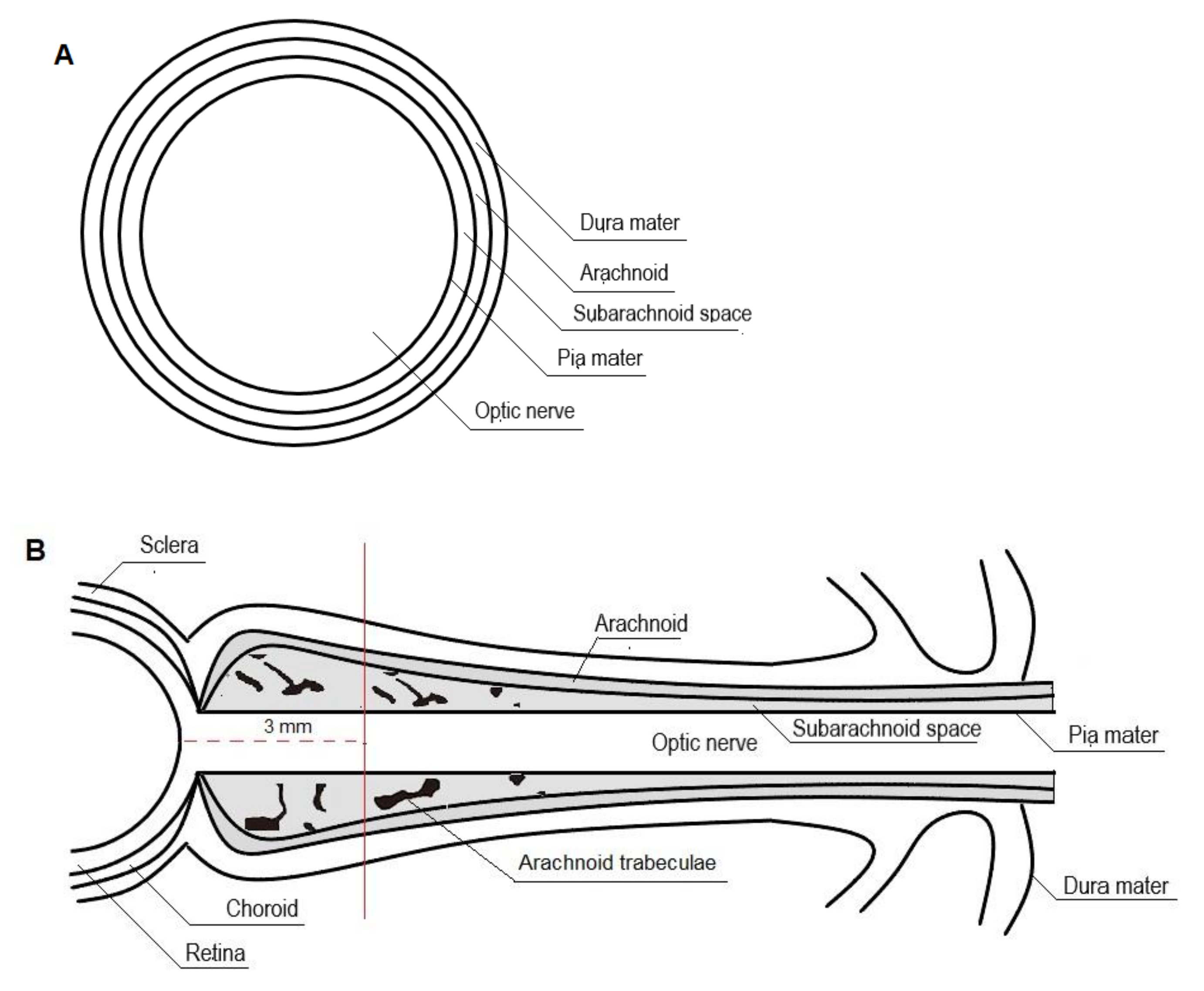 Diagnostics | Free Full-Text | Optic Nerve Sheath Diameter Ultrasound: A  Non-Invasive Approach to Evaluate Increased Intracranial Pressure in  Critically Ill Pediatric Patients
