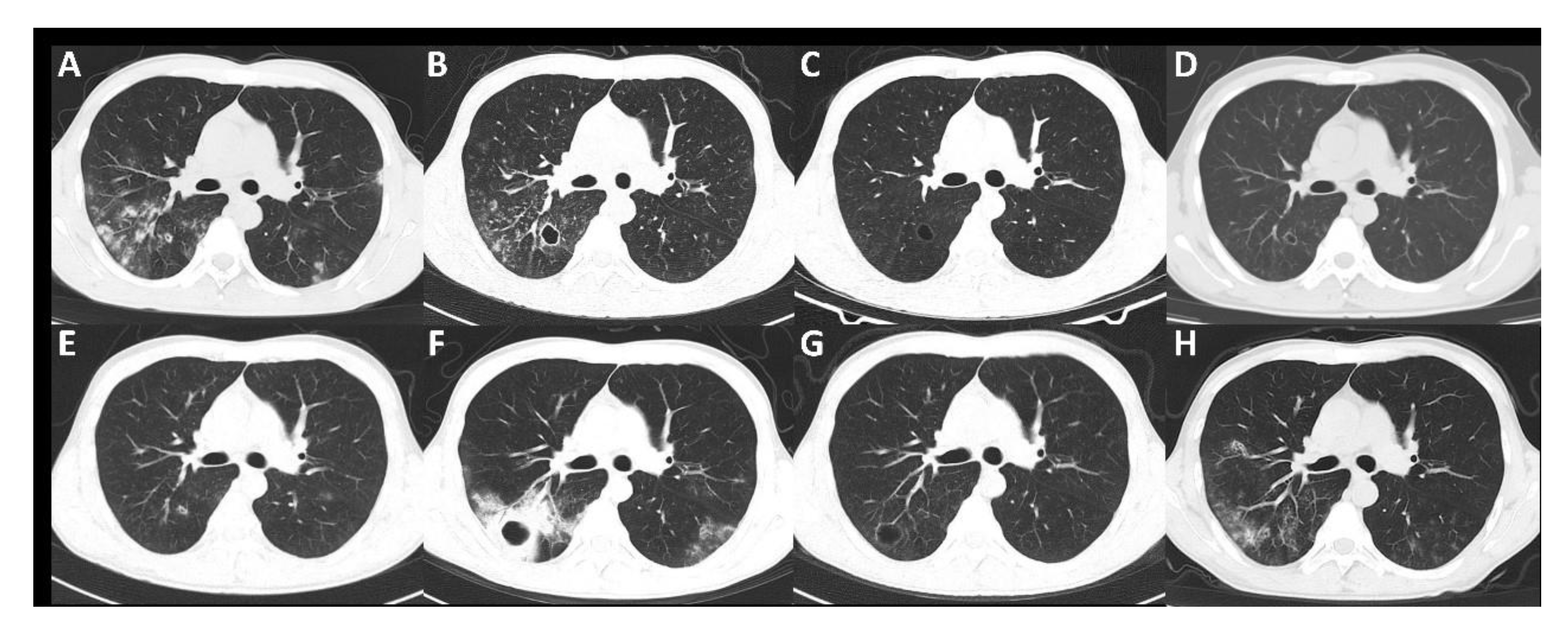 Diagnostics 12 00772 g002 550
