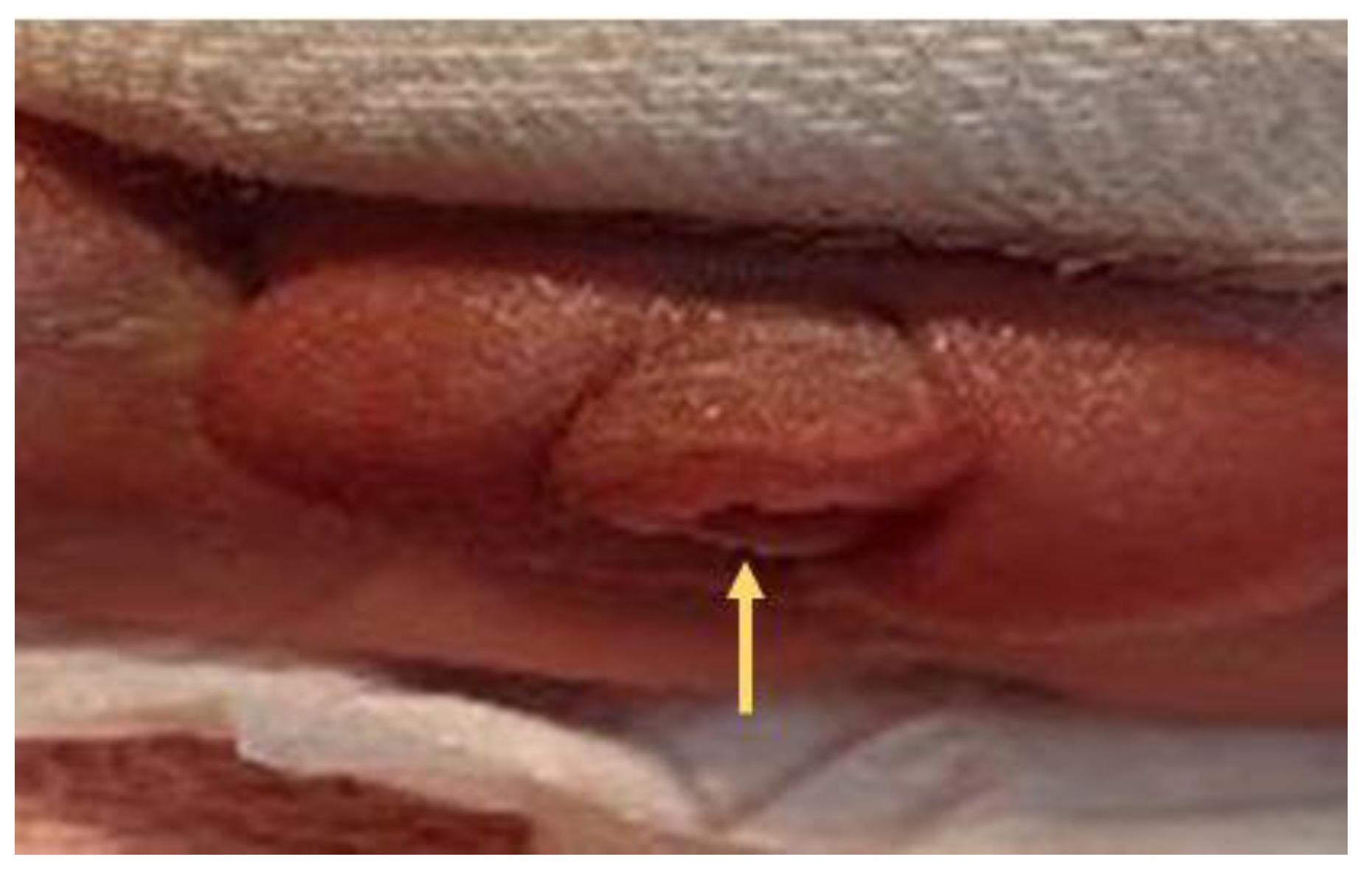 Diagnostics 12 00774 g009 Diagnostics 12 00774 g009