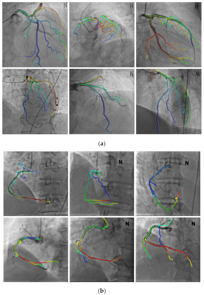Diagnostics 12 00778 g012 550