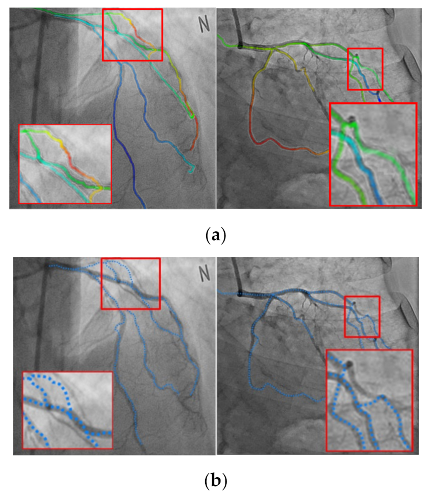 Diagnostics 12 00778 g015 550
