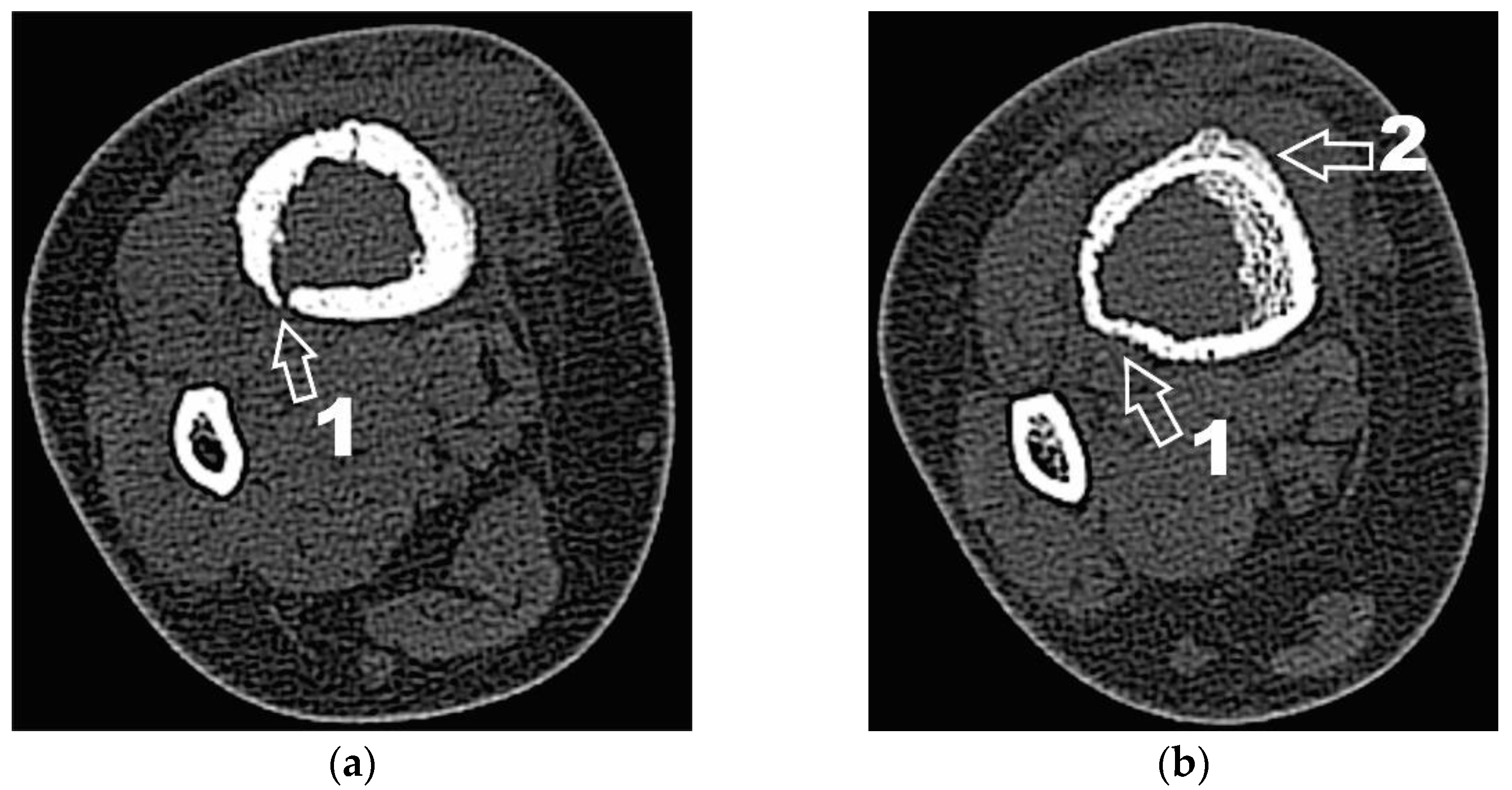 Diagnostics 12 00783 g004