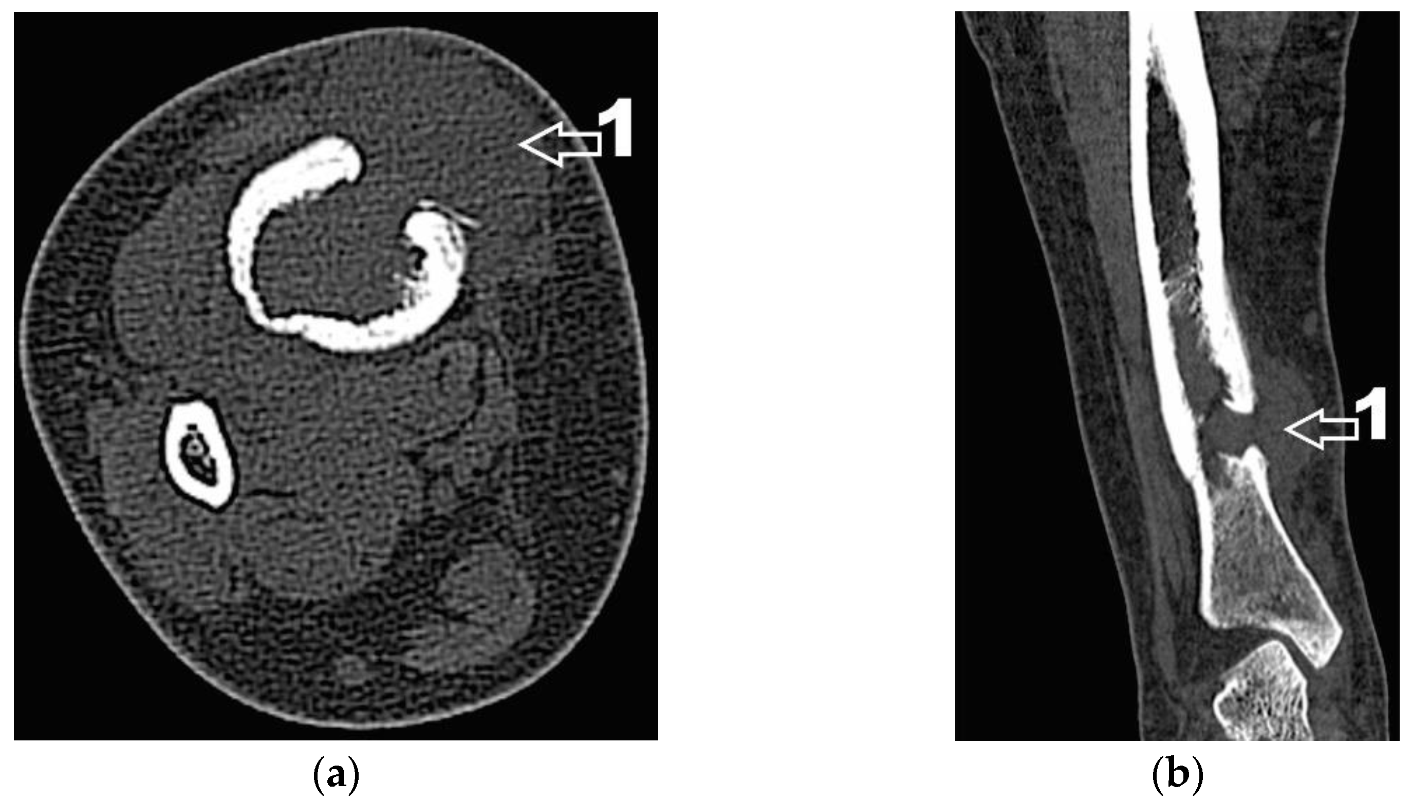 Diagnostics 12 00783 g005