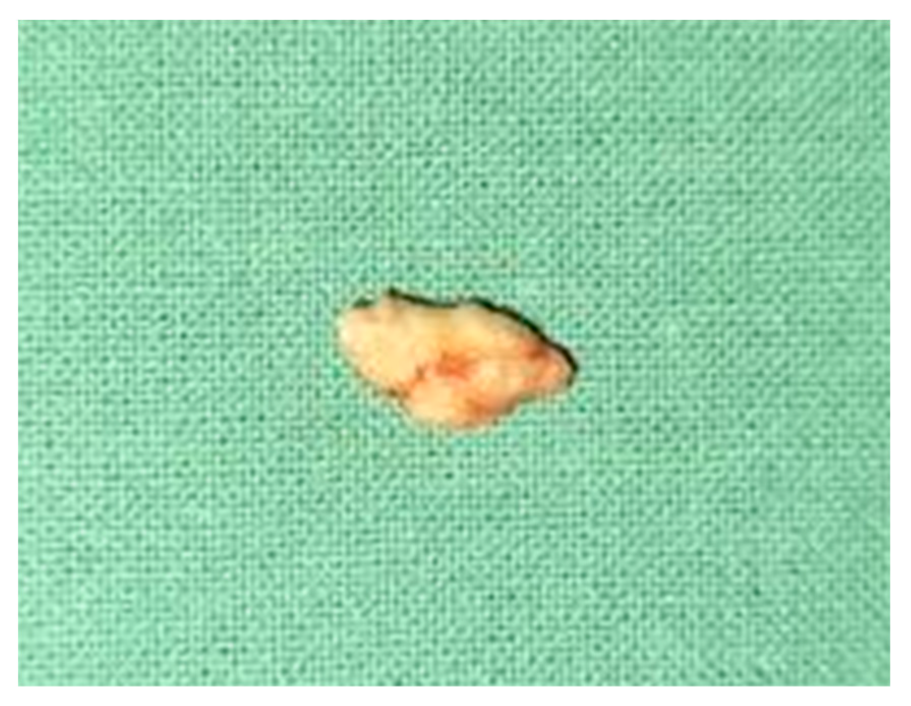 Diagnostics 12 00792 g004