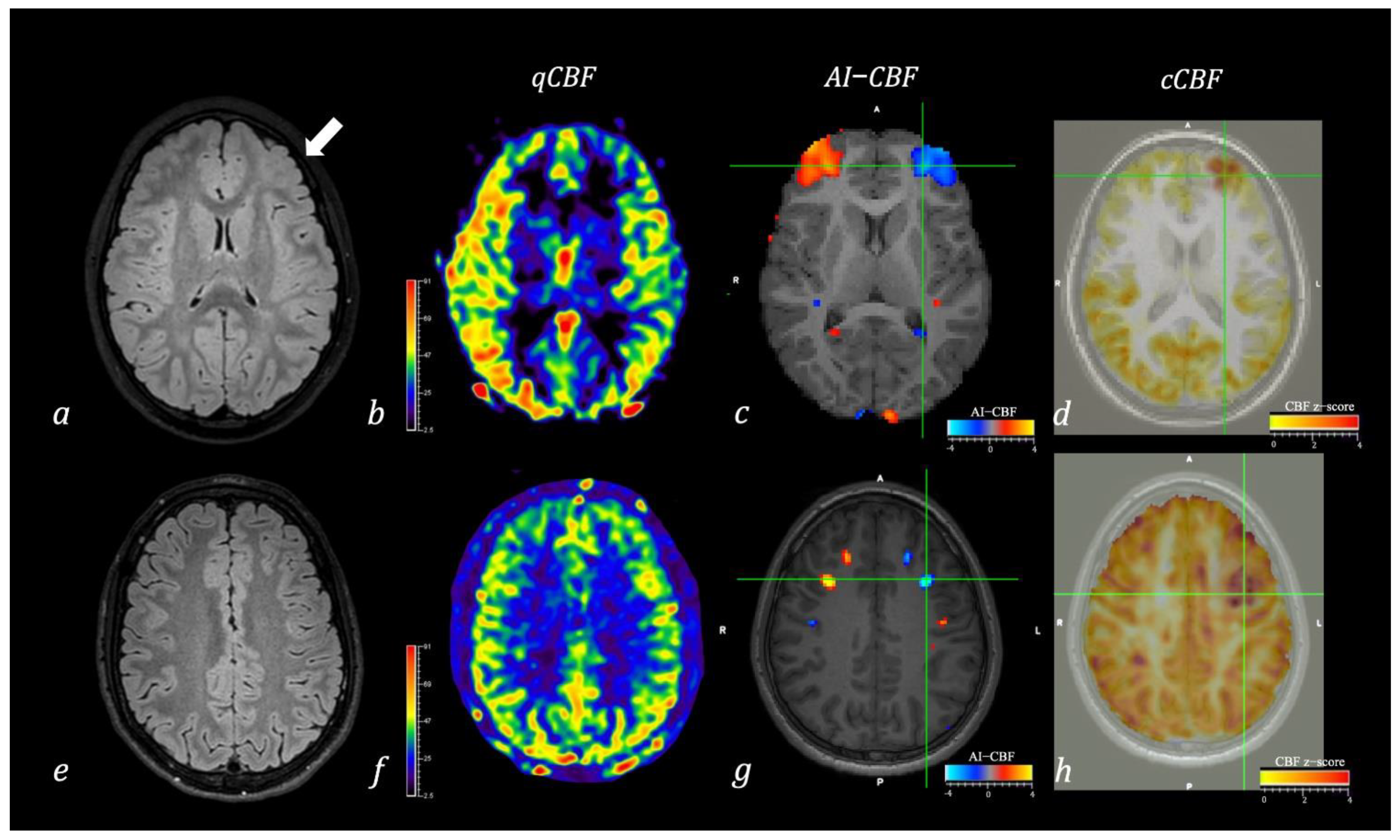 Results of whole brain analyses in the test scan. a The left parietal