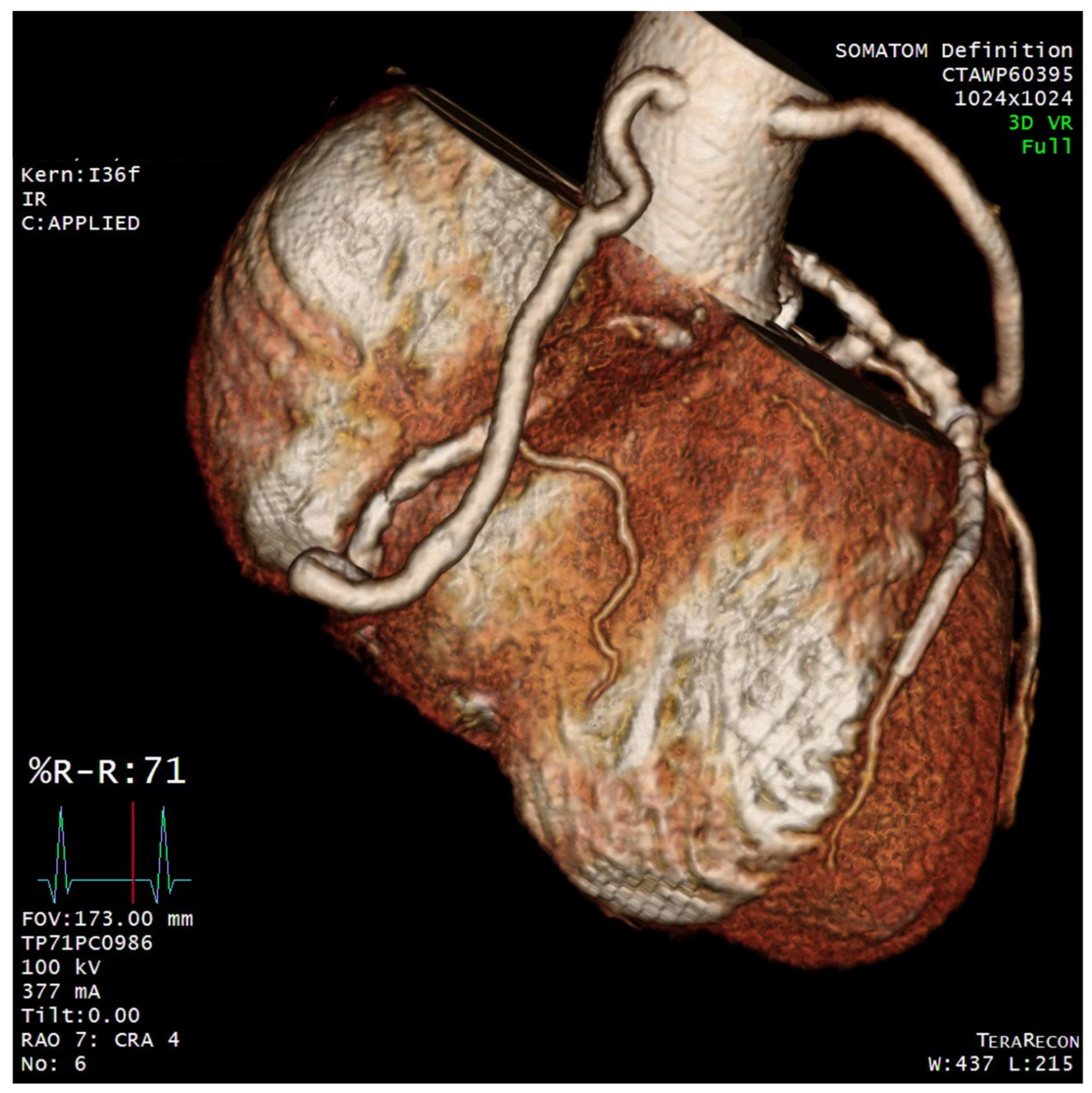 Diagnostics 12 00815 g002 550
