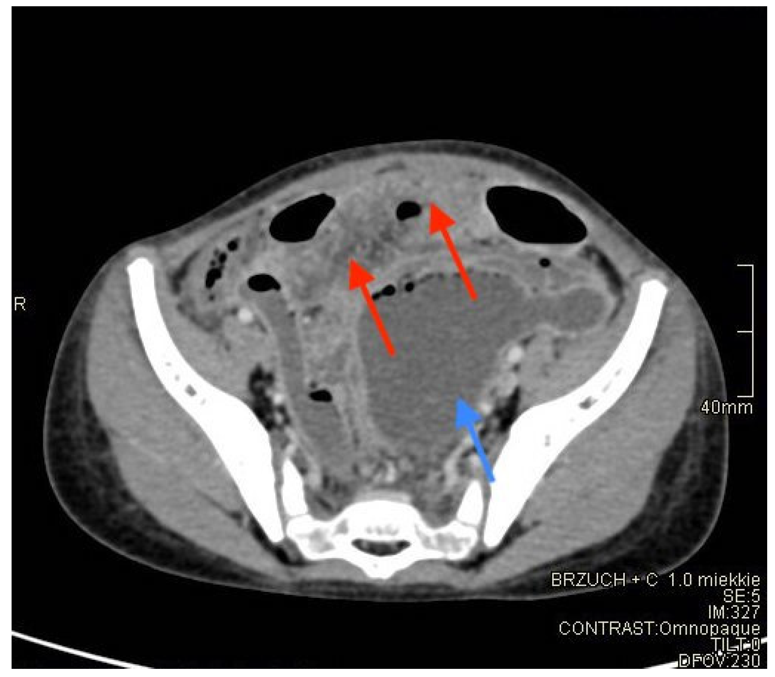Diagnostics 12 00818 g002 550