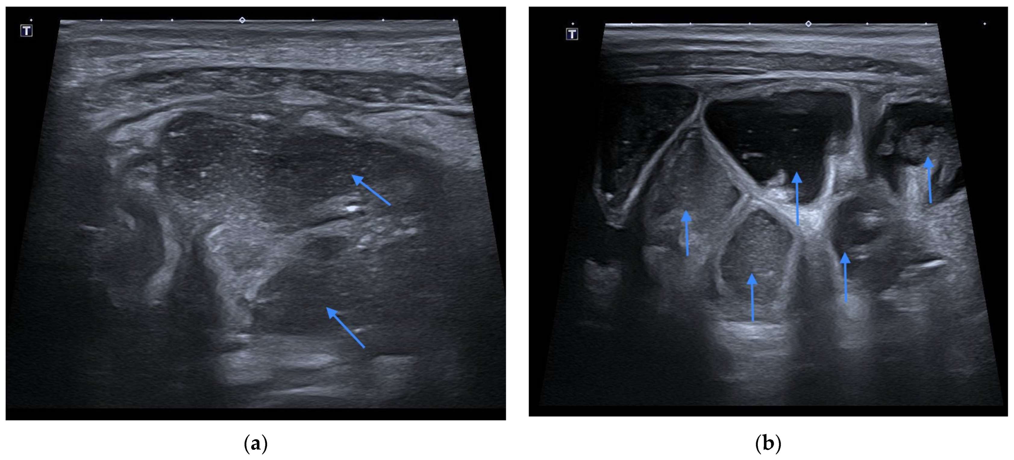 Diagnostics 12 00818 g003 550