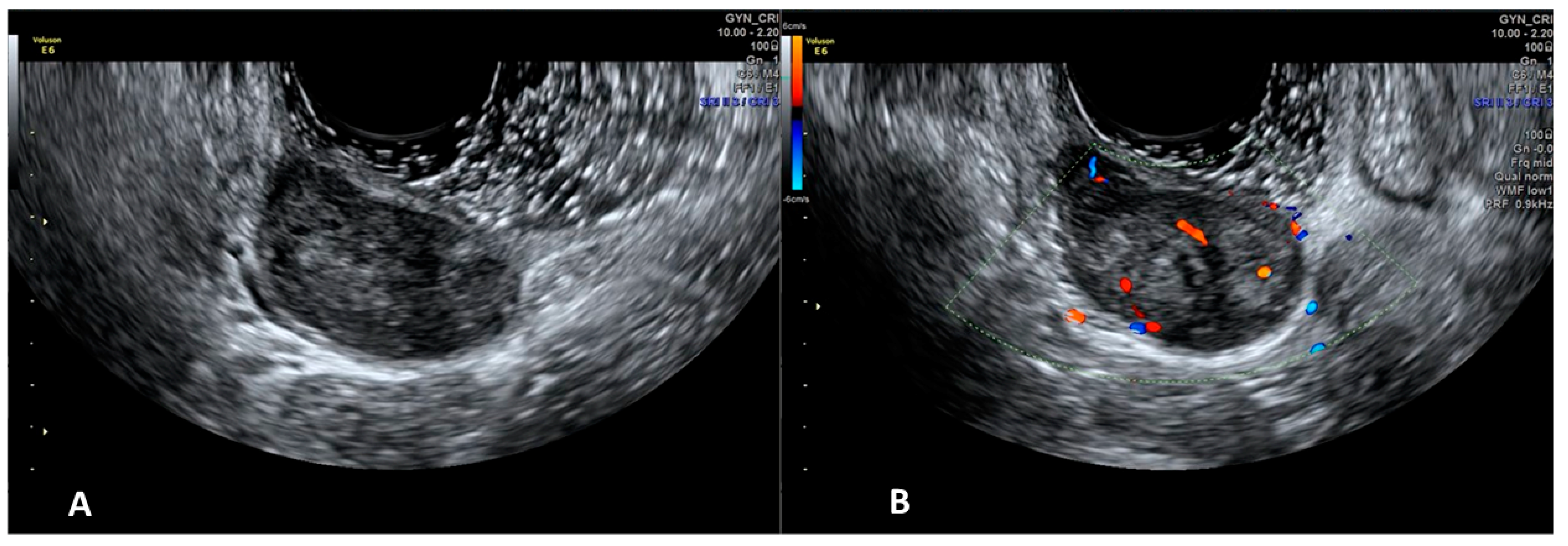 Diagnostics 12 00820 g002 Diagnostics 12 00820 g002