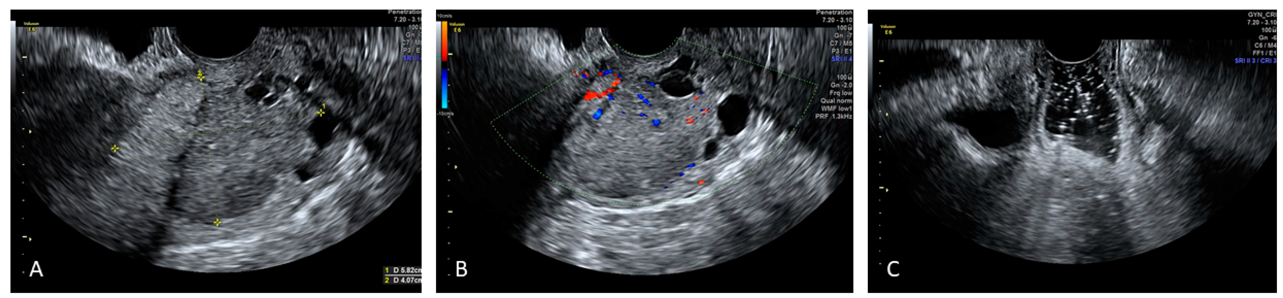 Diagnostics 12 00820 g004 Diagnostics 12 00820 g004