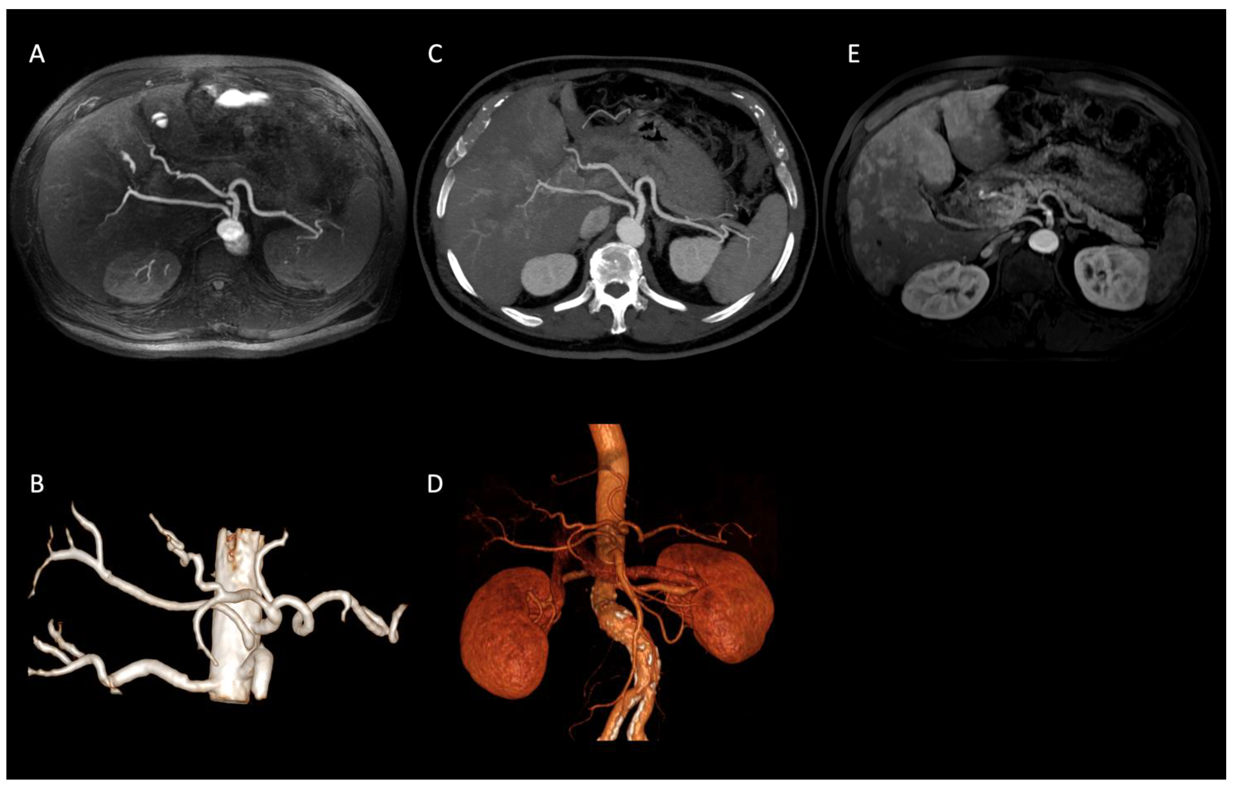 Diagnostics 12 00825 g002