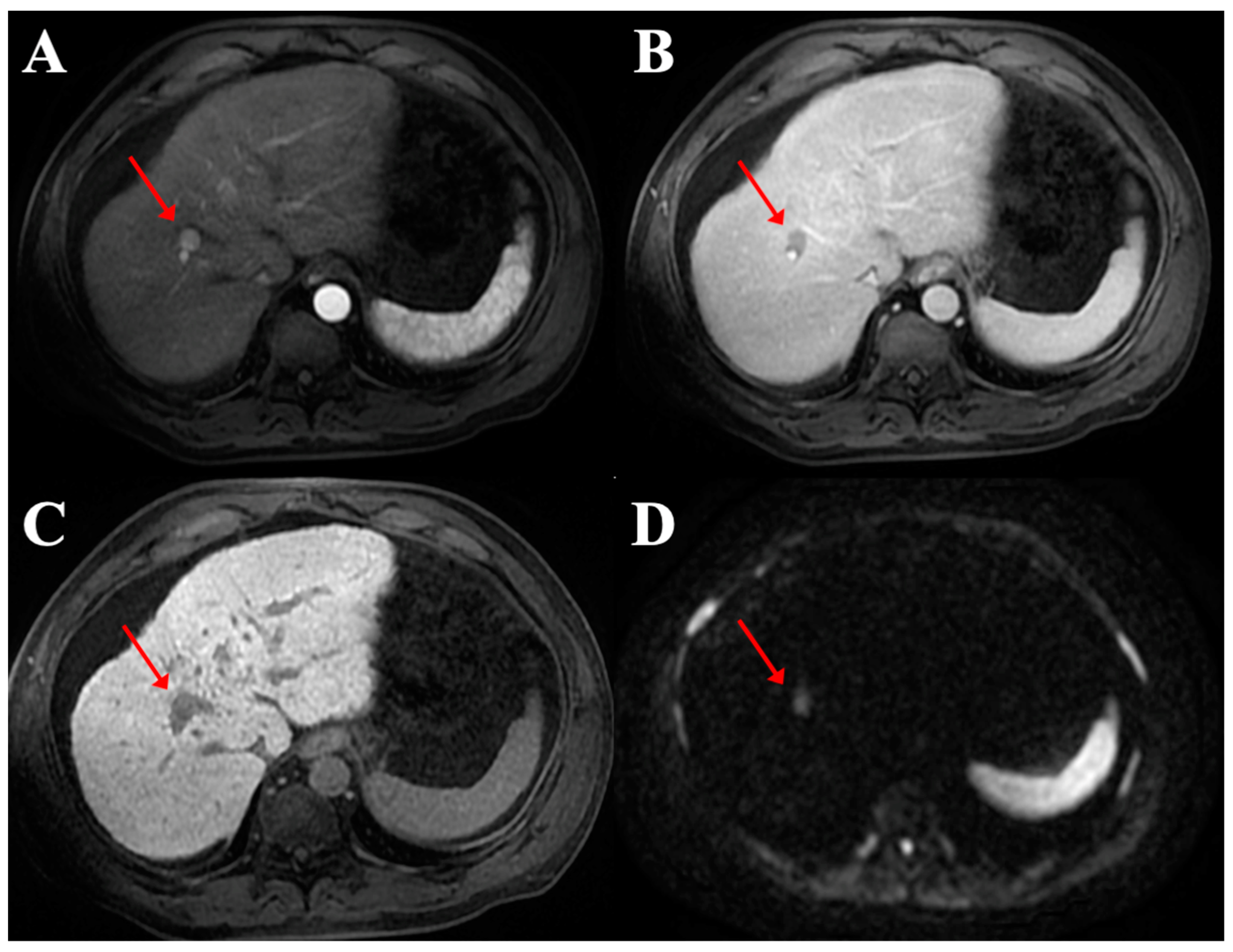 Diagnostics 12 00834 g004