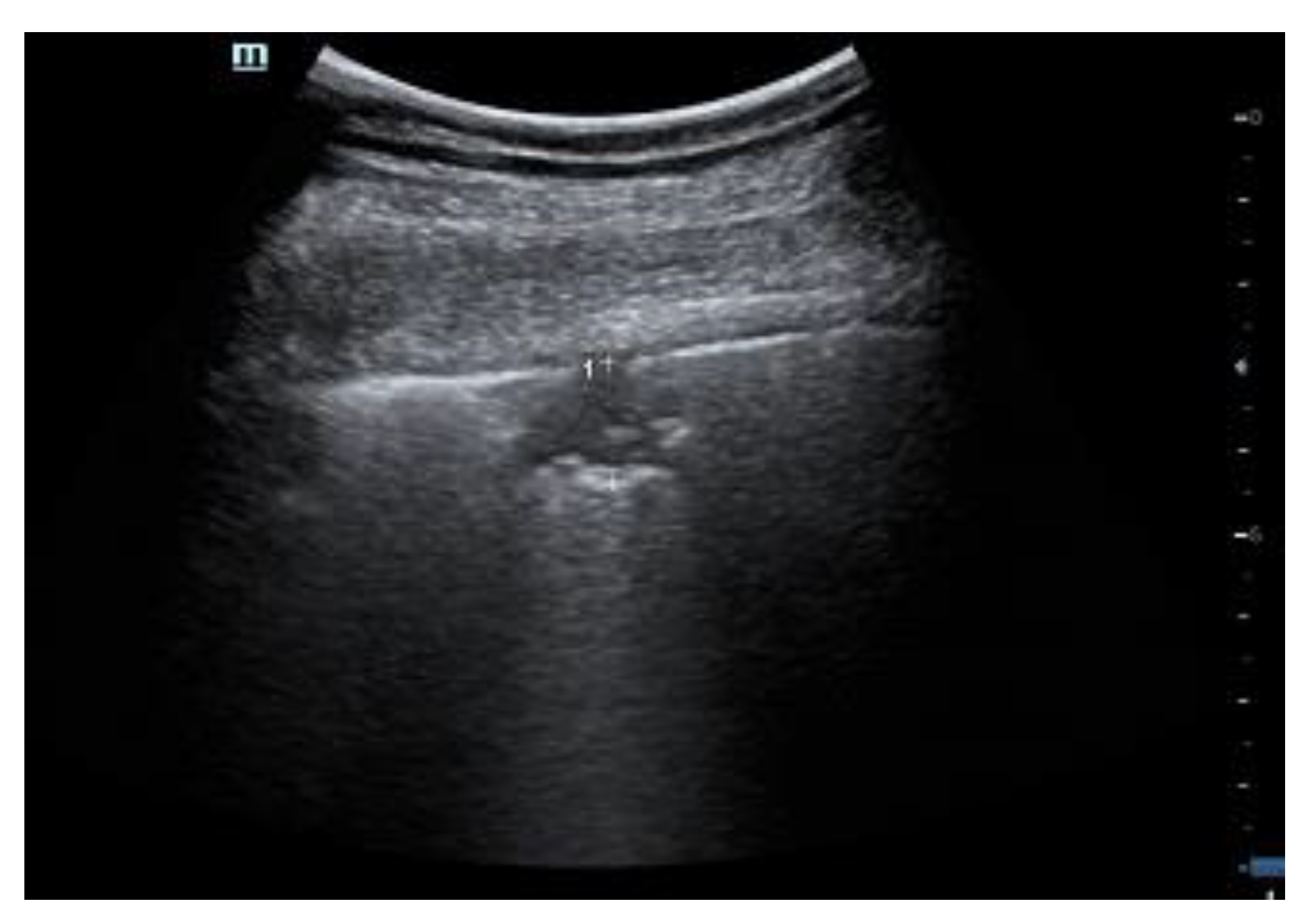 Diagnostics 12 00838 g005