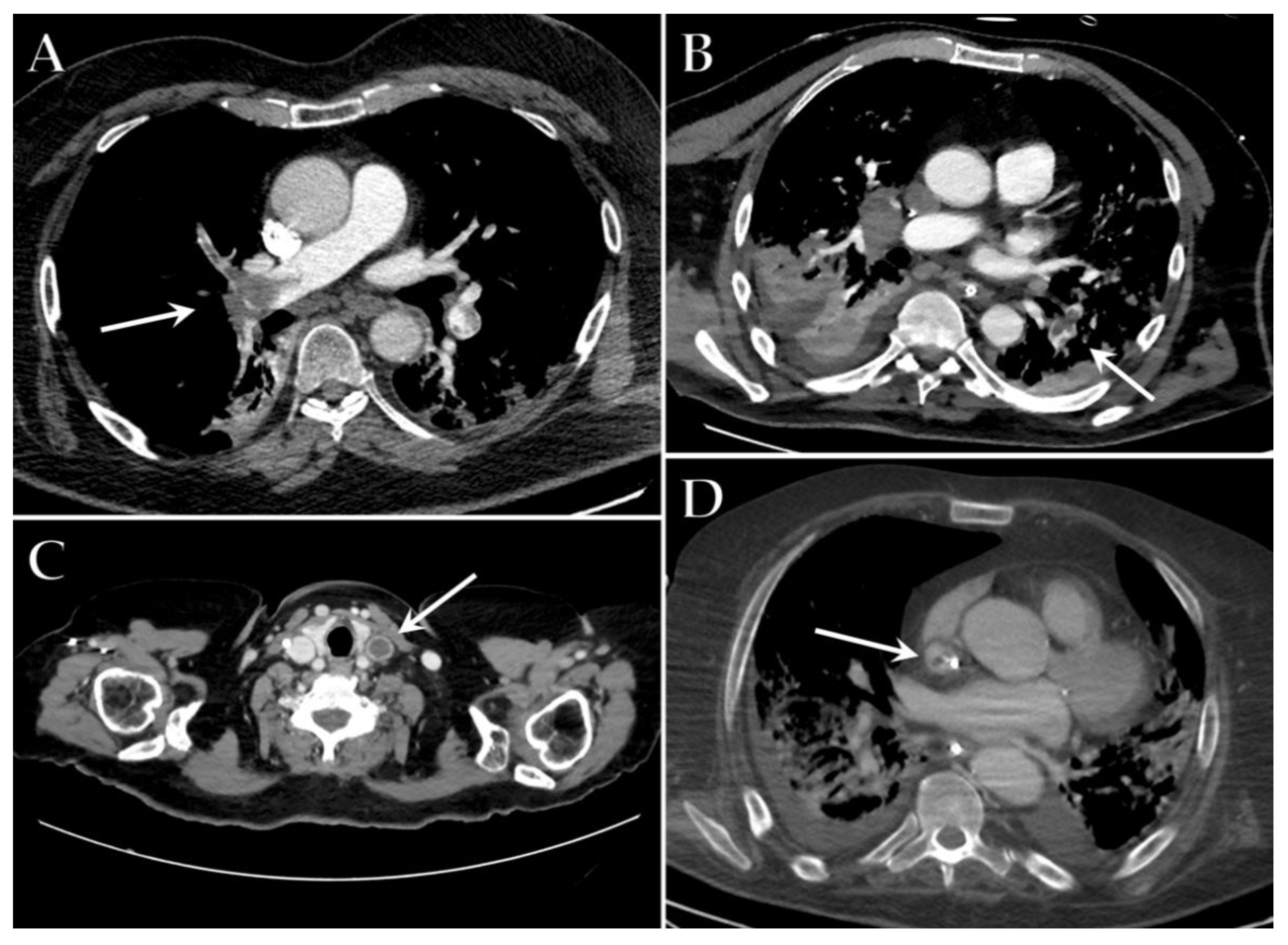 Diagnostics 12 00846 g004 550