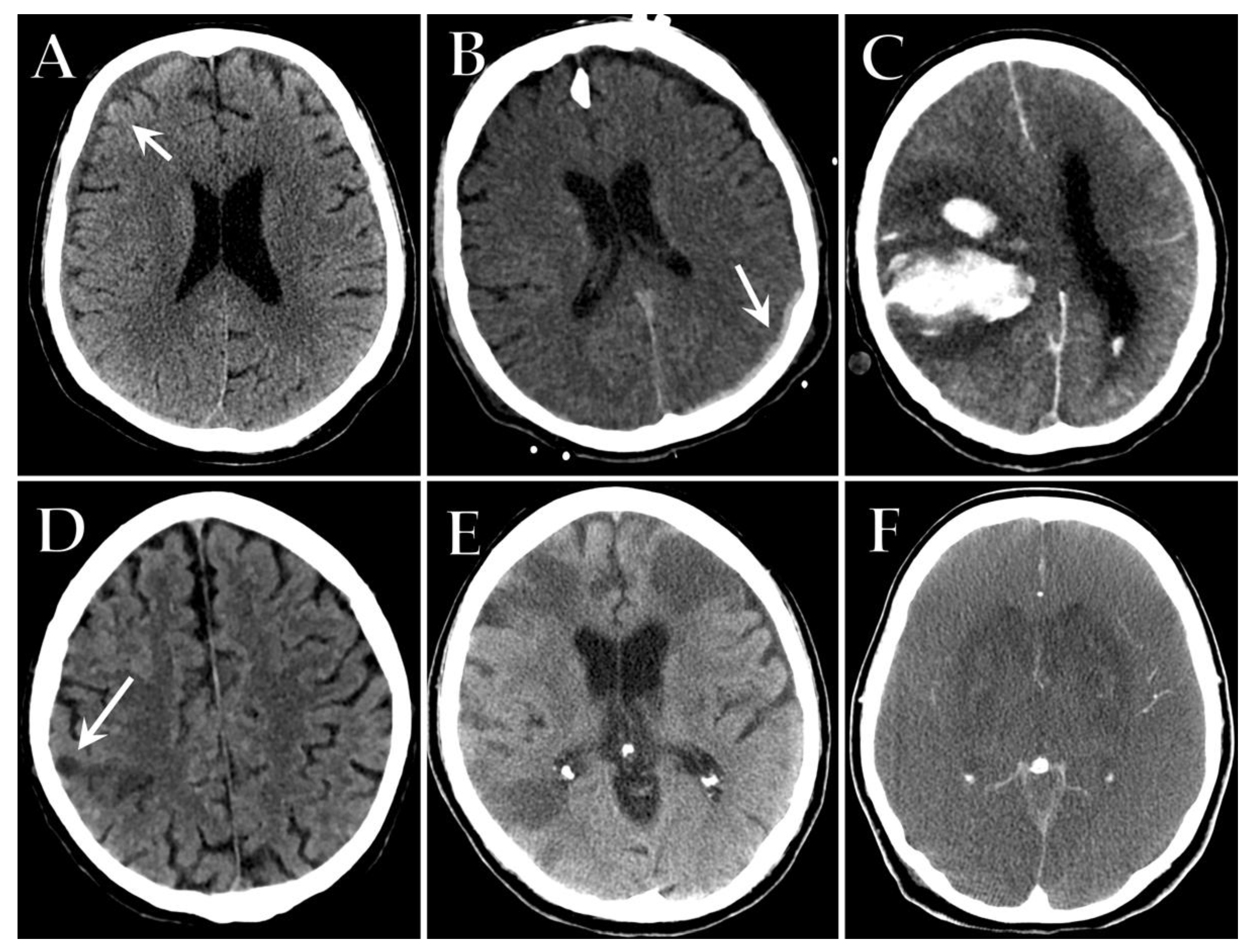 Diagnostics 12 00846 g008 550