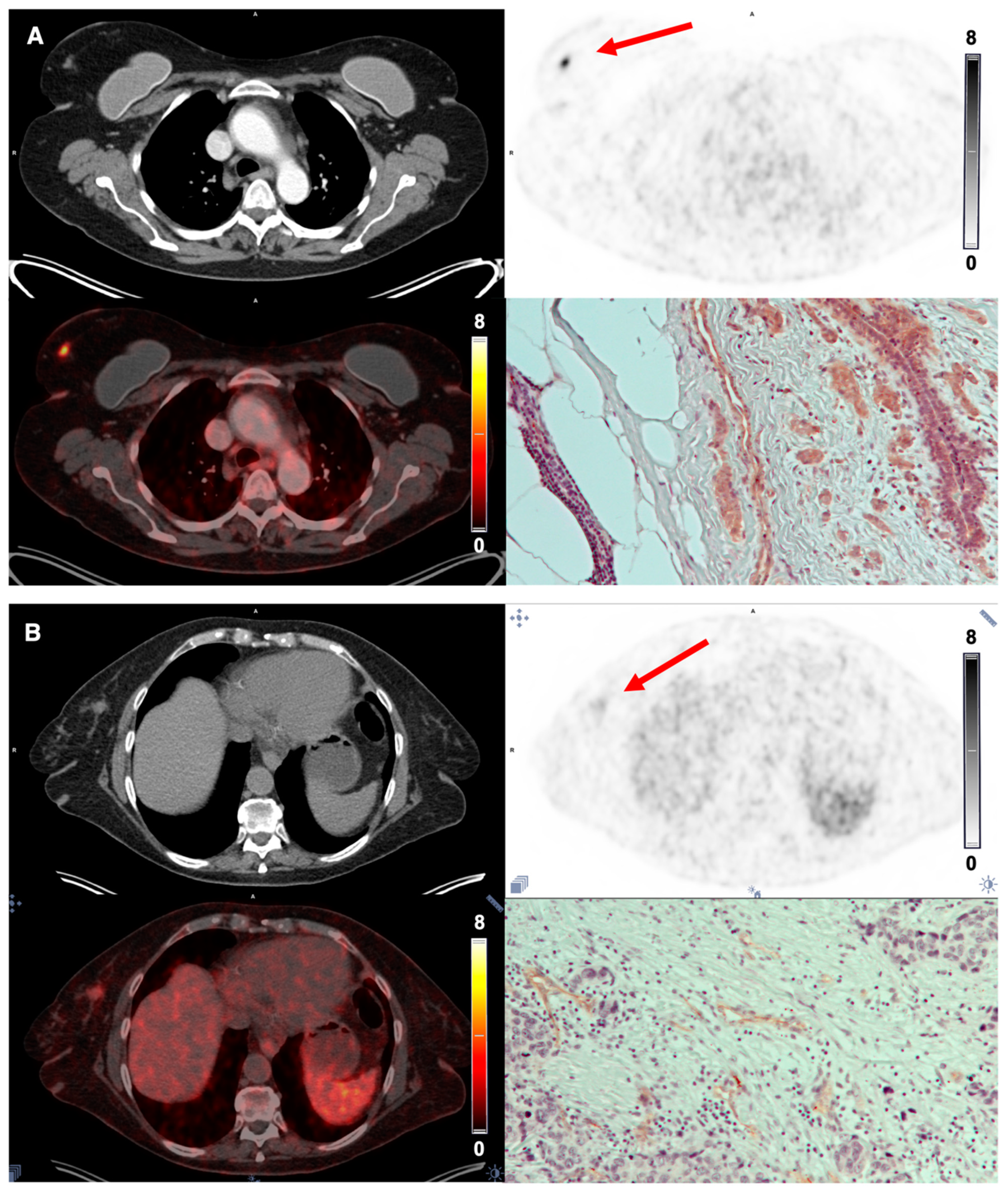 Diagnostics 12 00851 g005 550