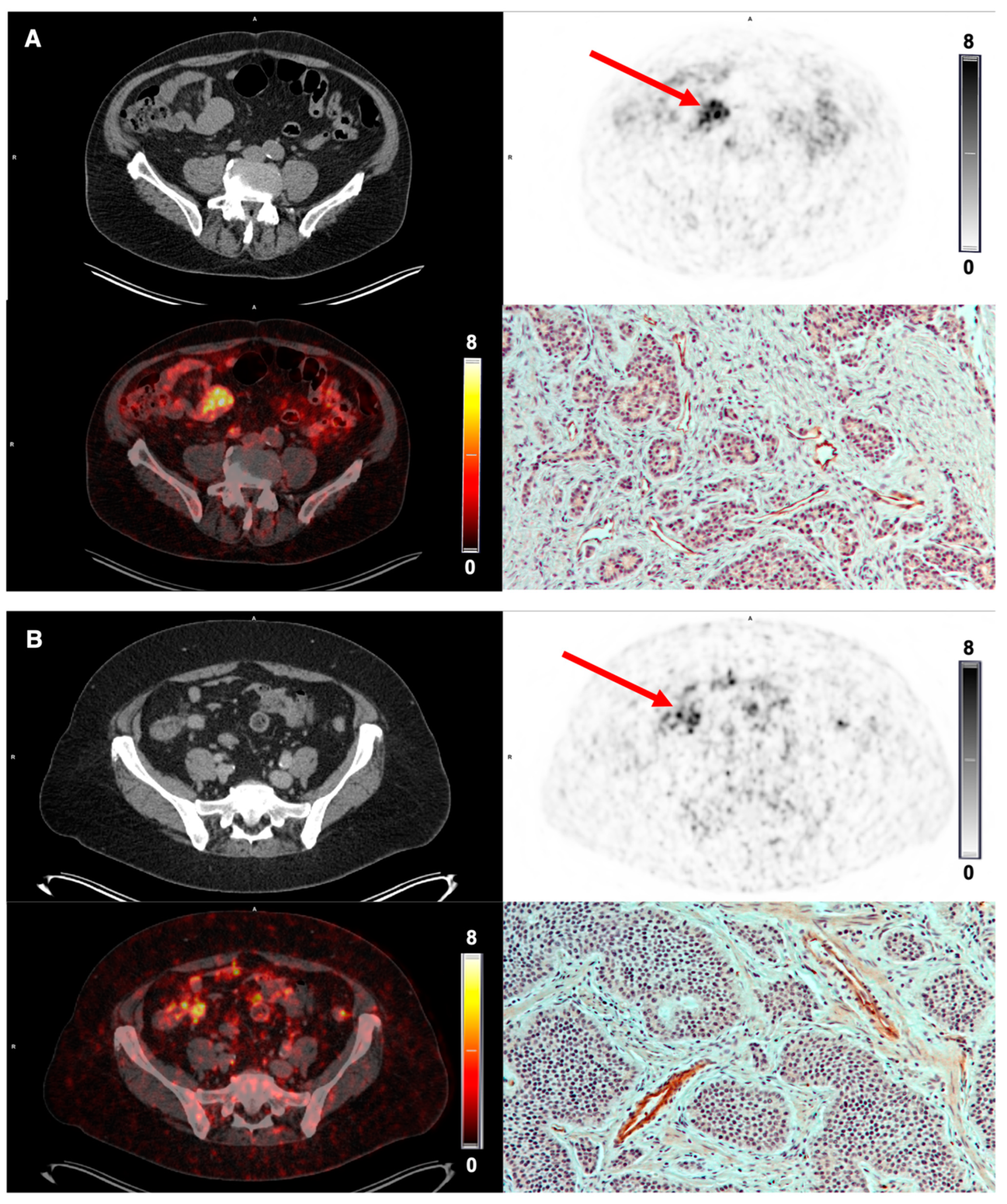 Diagnostics 12 00851 g006 550