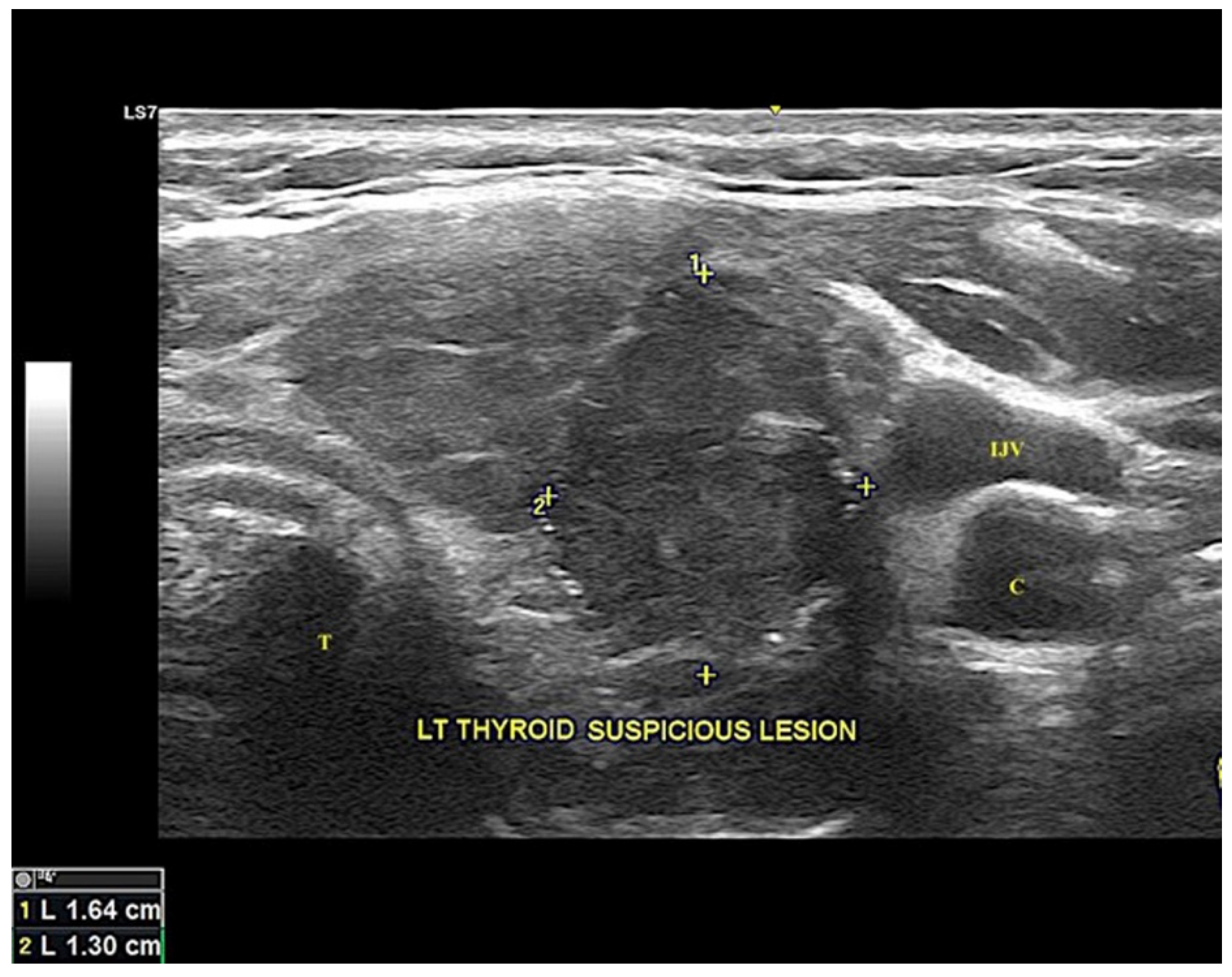 Diagnostics 12 00855 g001 550