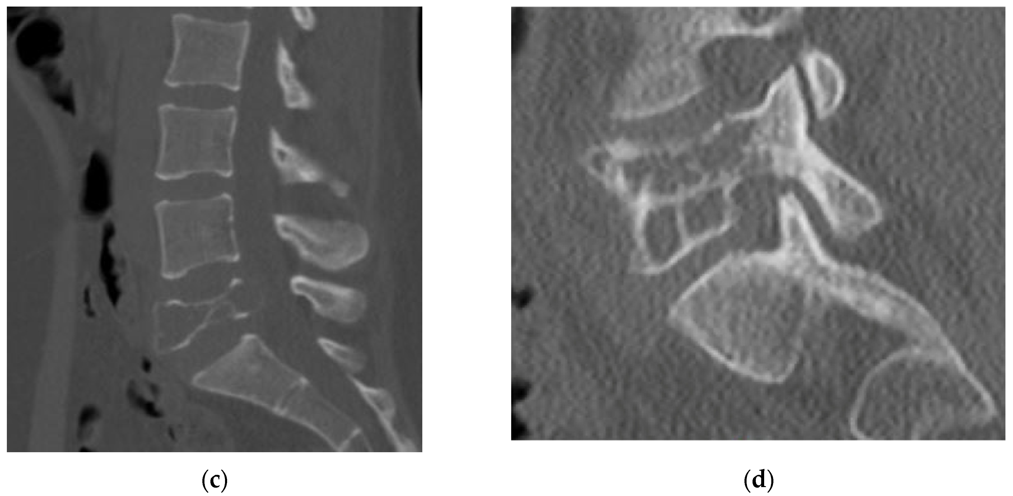 Diagnostics 12 00857 g002b