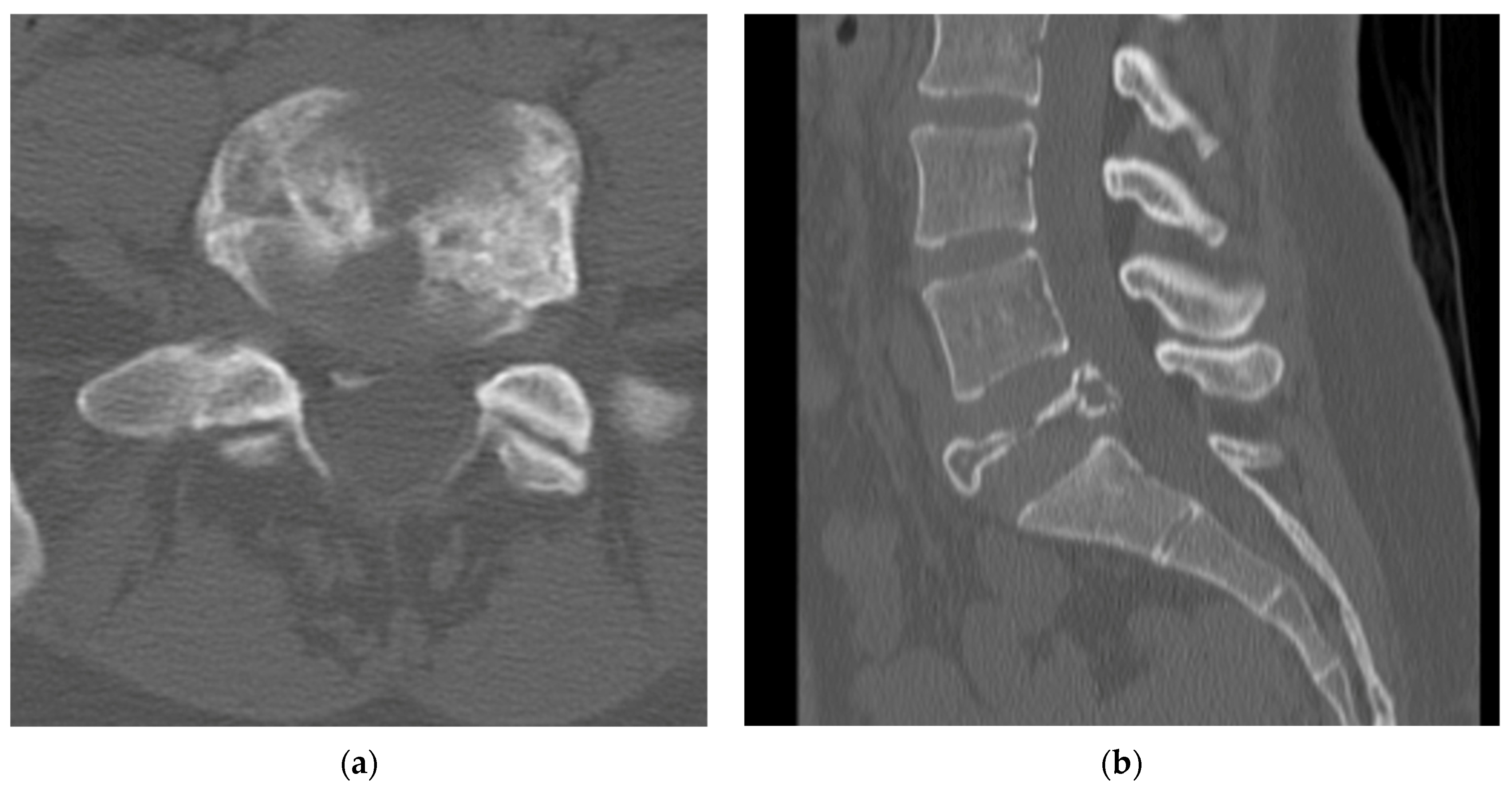 Diagnostics 12 00857 g006