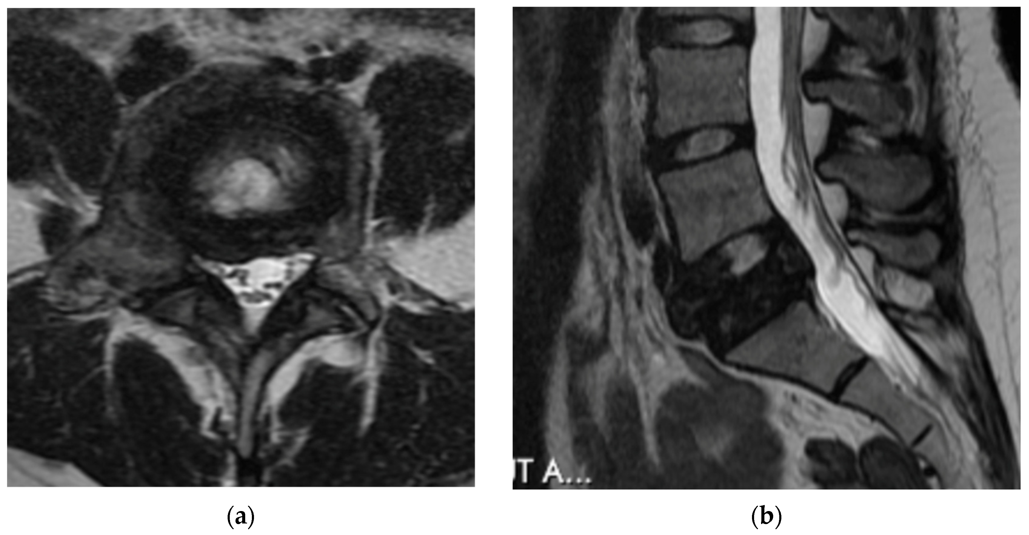 Diagnostics 12 00857 g007